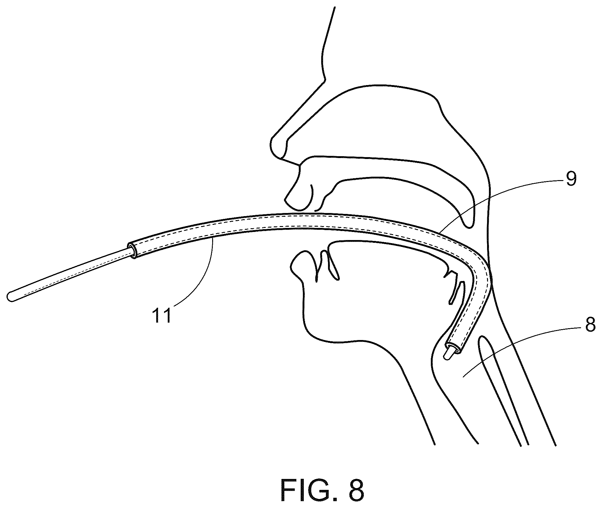 Patent US12496416 Figure 8 – Tracheal introducer sheath
