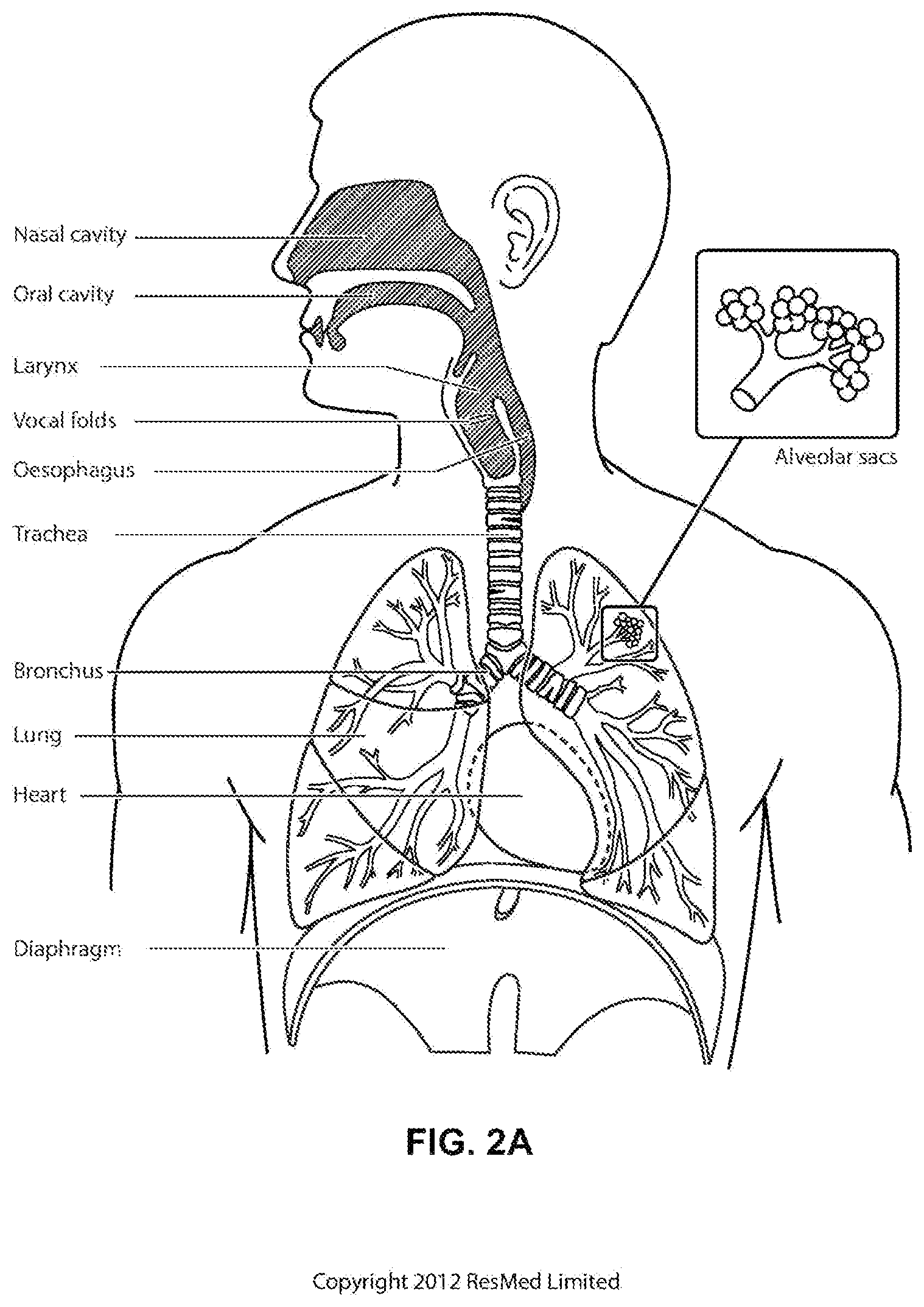 Patent US12496420 Figure 4 – Vent for a respiratory pressure therapy system