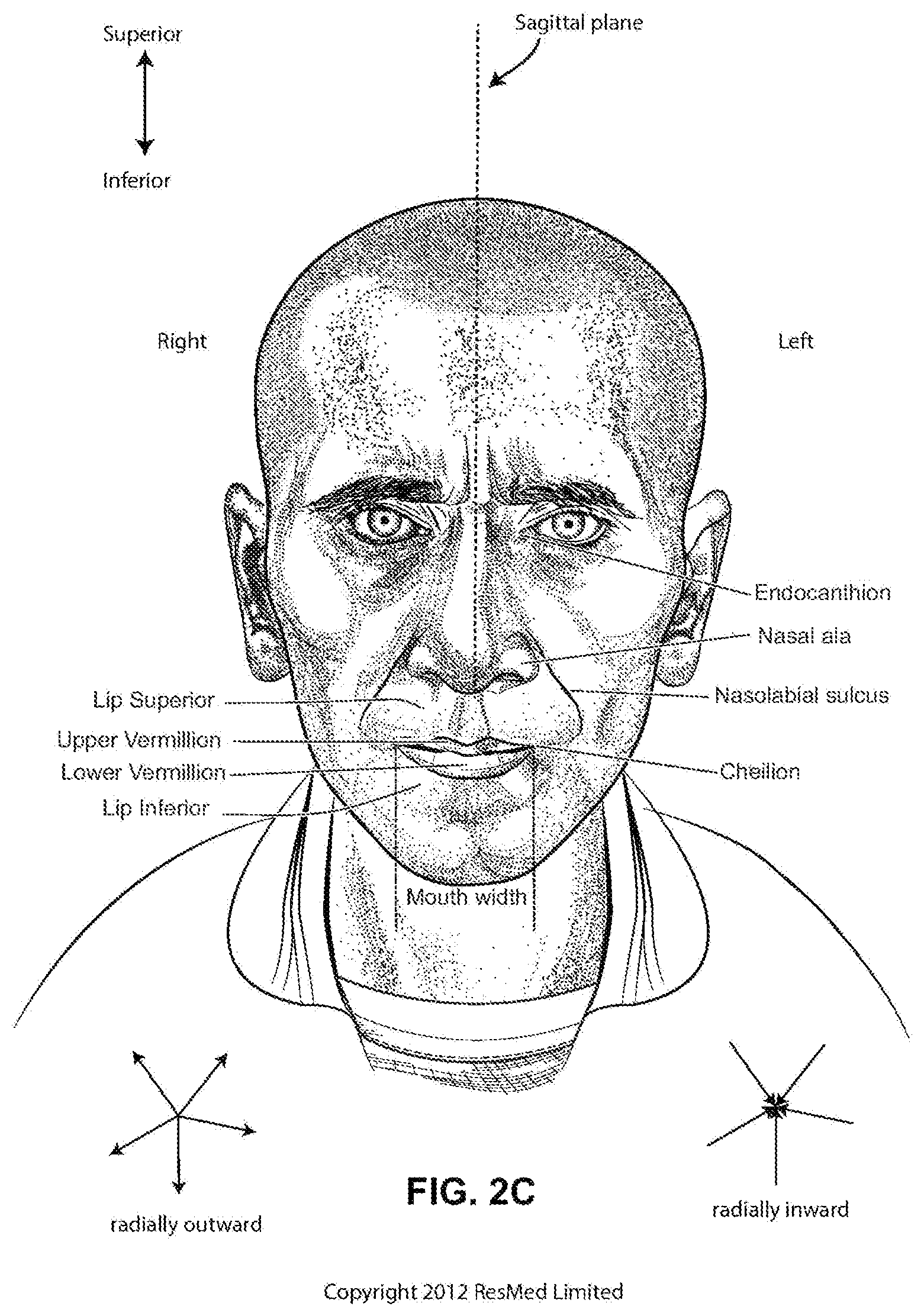 Patent US12496420 Figure 6 – Vent for a respiratory pressure therapy system