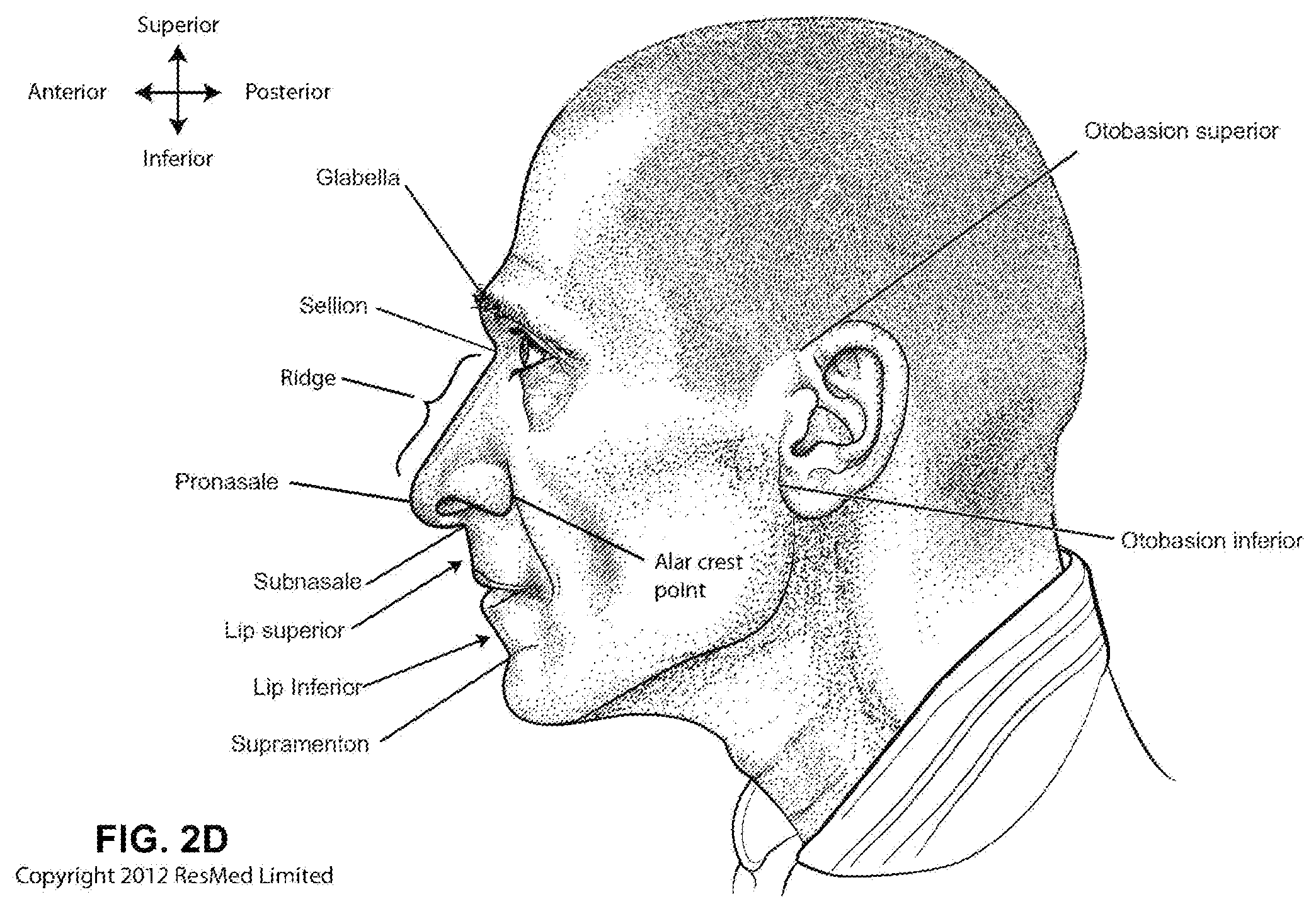 Patent US12496420 Figure 7 – Vent for a respiratory pressure therapy system