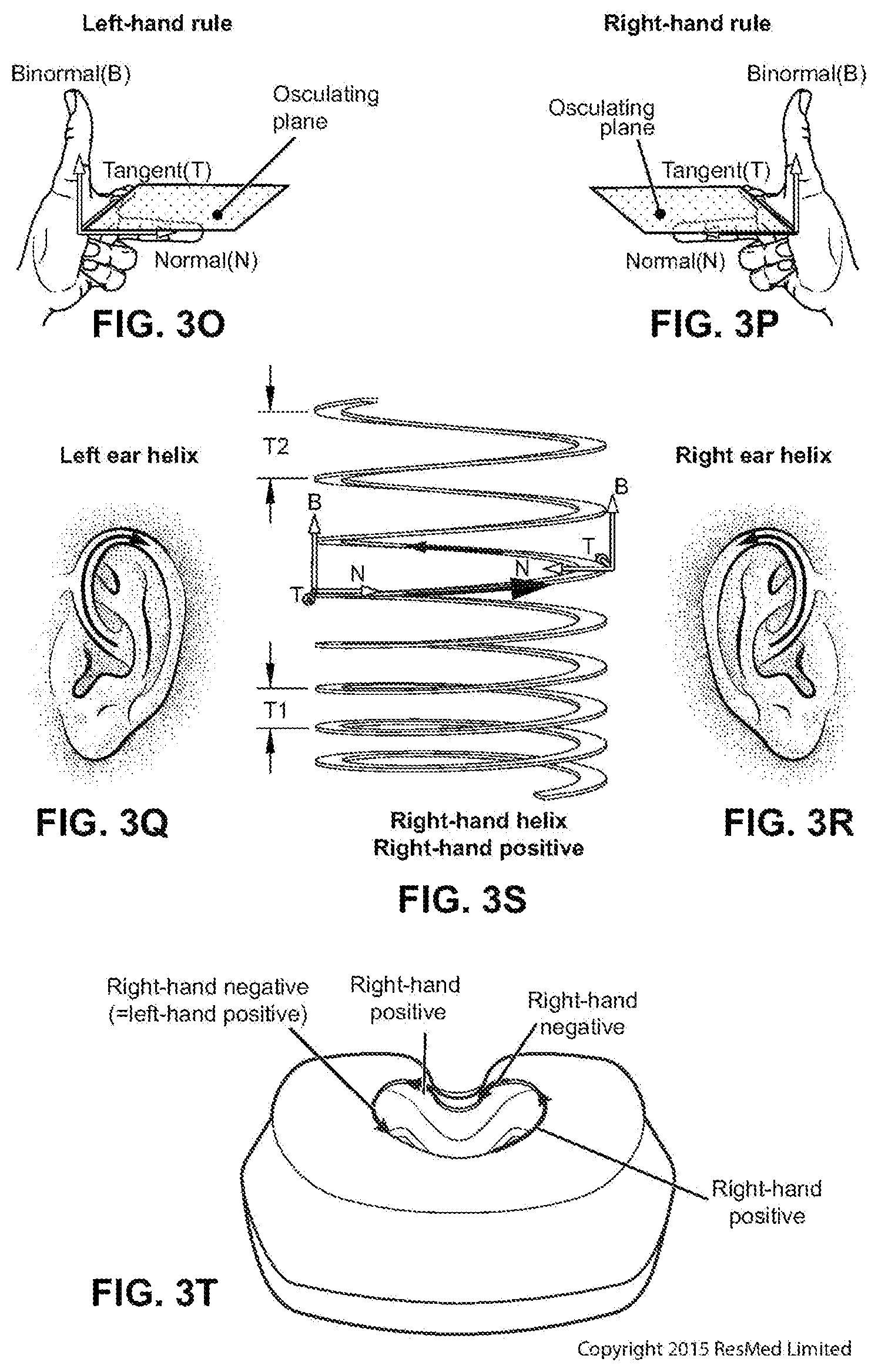 Patent US12496420 Figure 17 – Vent for a respiratory pressure therapy system