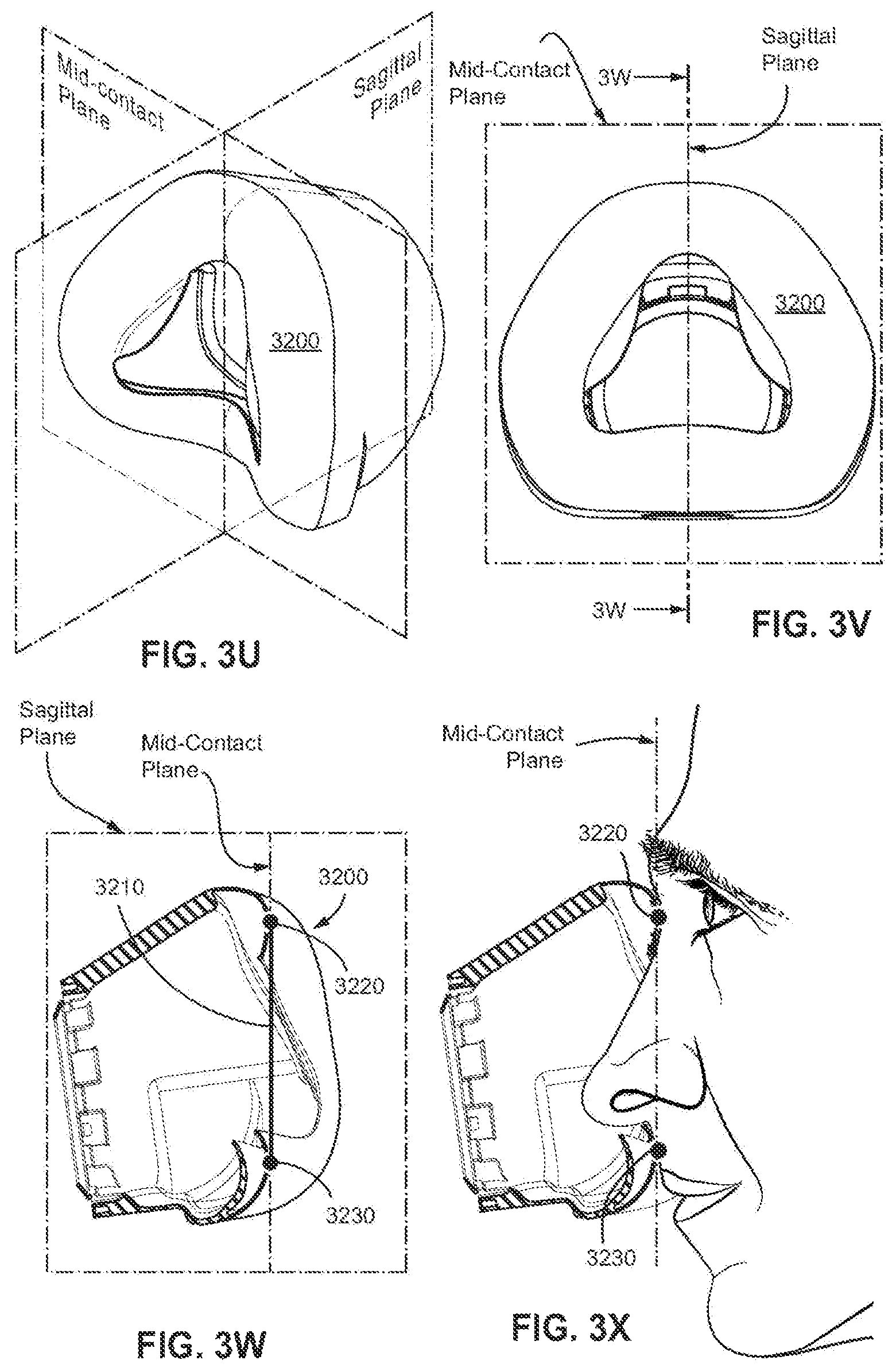Patent US12496420 Figure 18 – Vent for a respiratory pressure therapy system