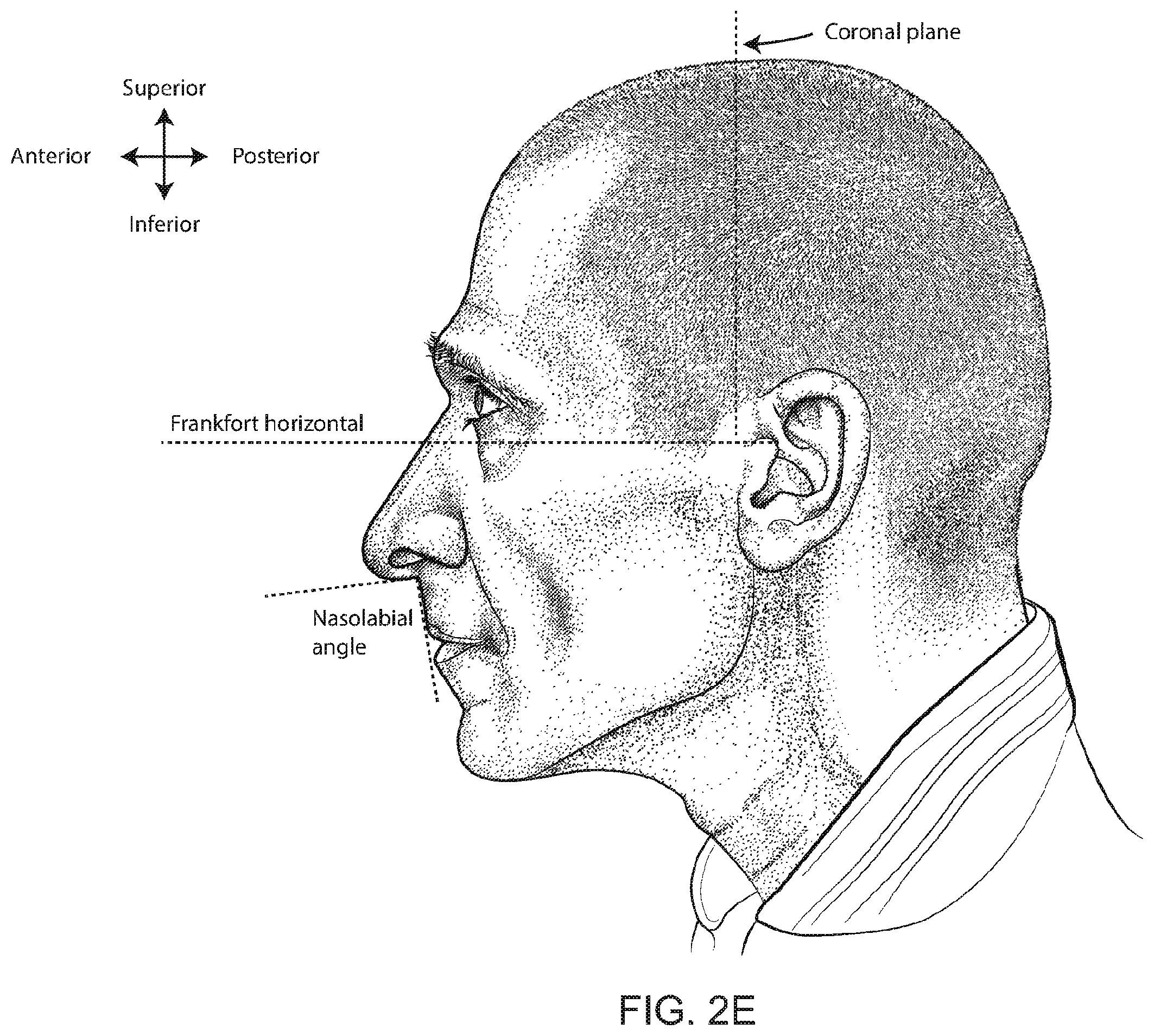 Patent US12496422 Figure 8 – Air delivery conduit