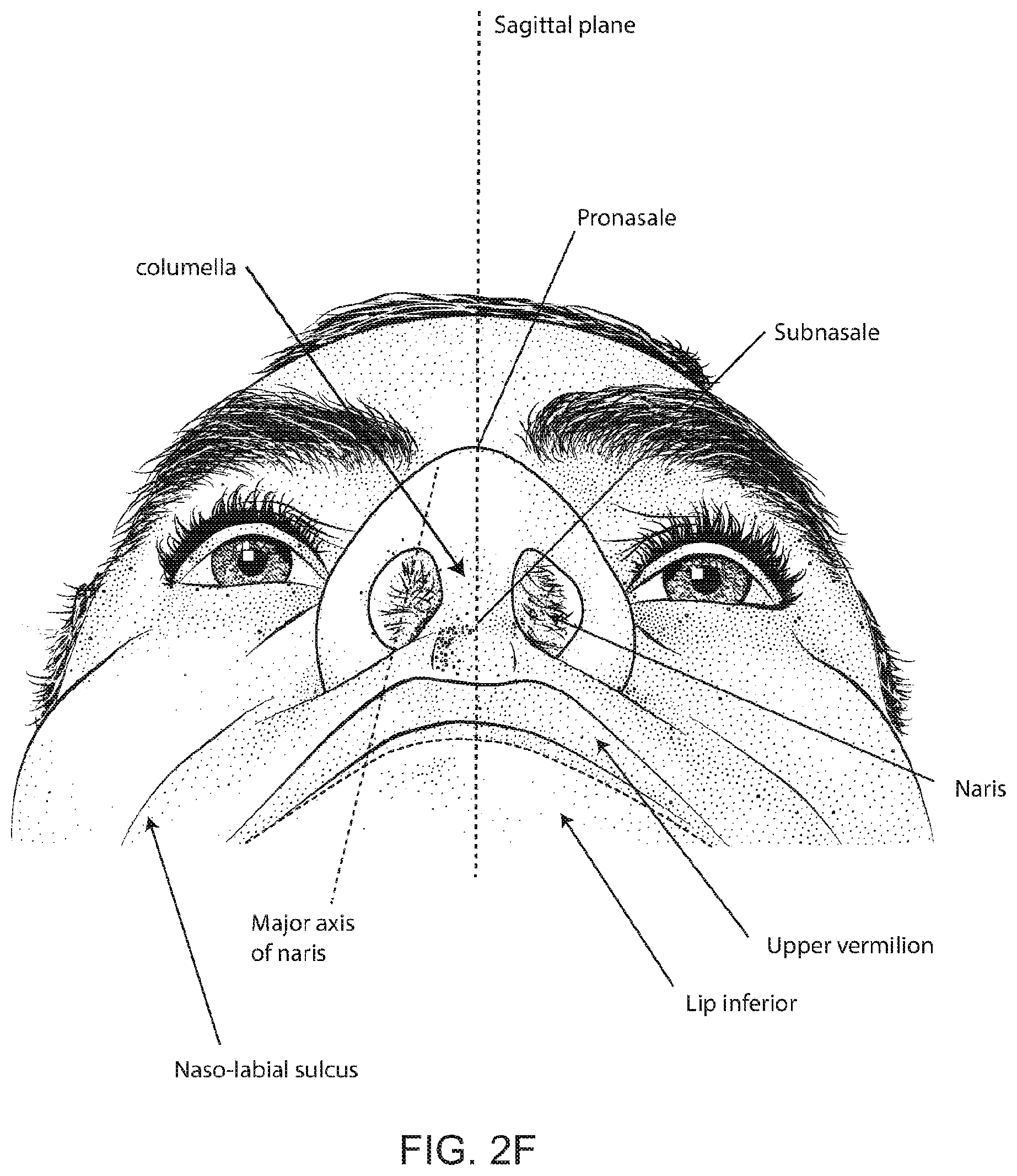 Patent US12496422 Figure 9 – Air delivery conduit