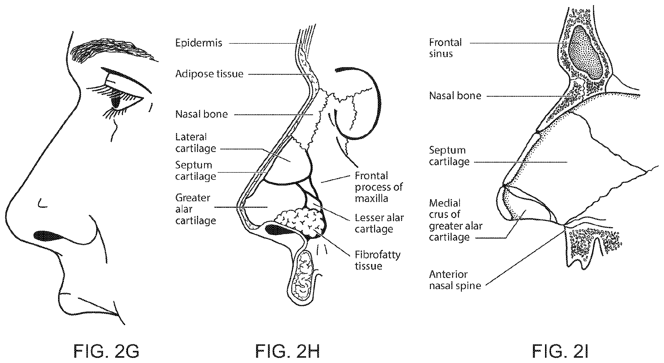 Patent US12496422 Figure 10 – Air delivery conduit