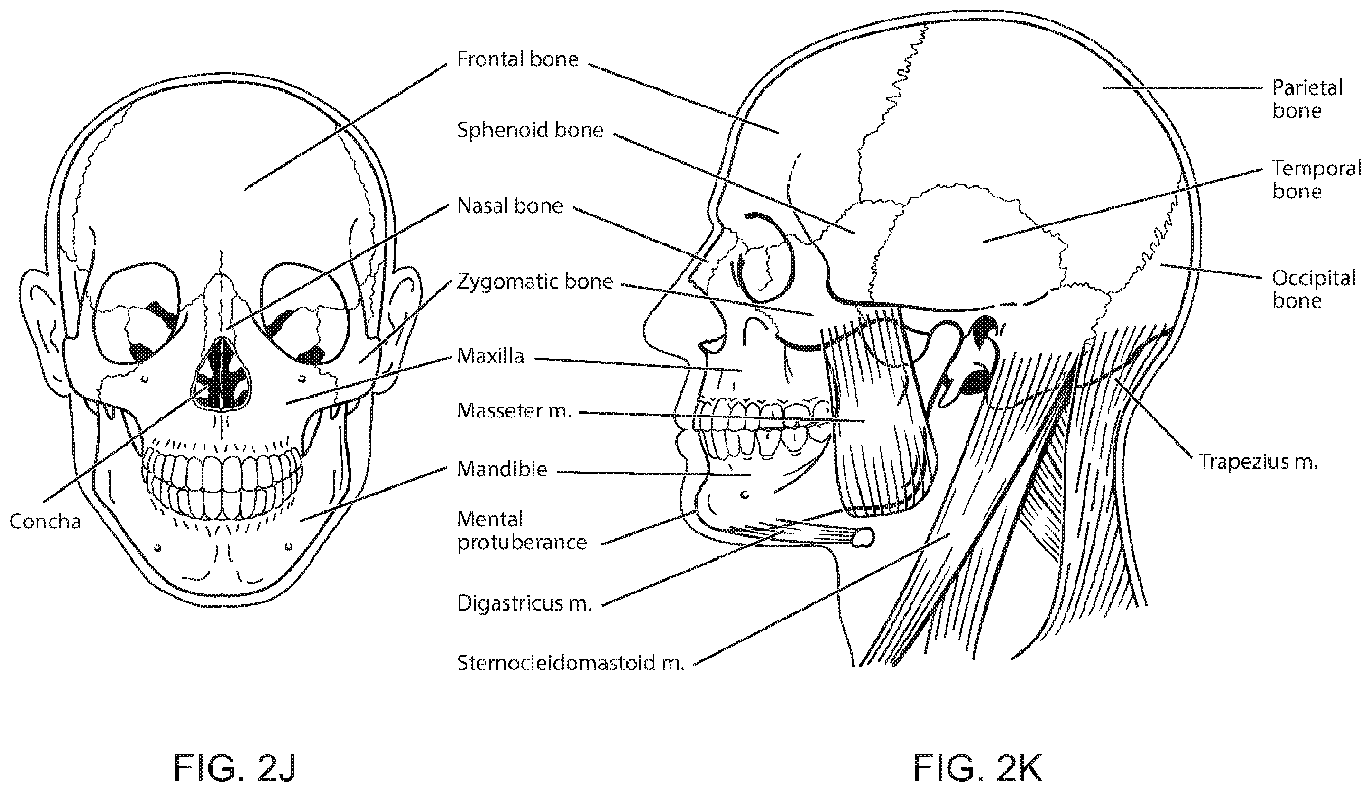 Patent US12496422 Figure 11 – Air delivery conduit