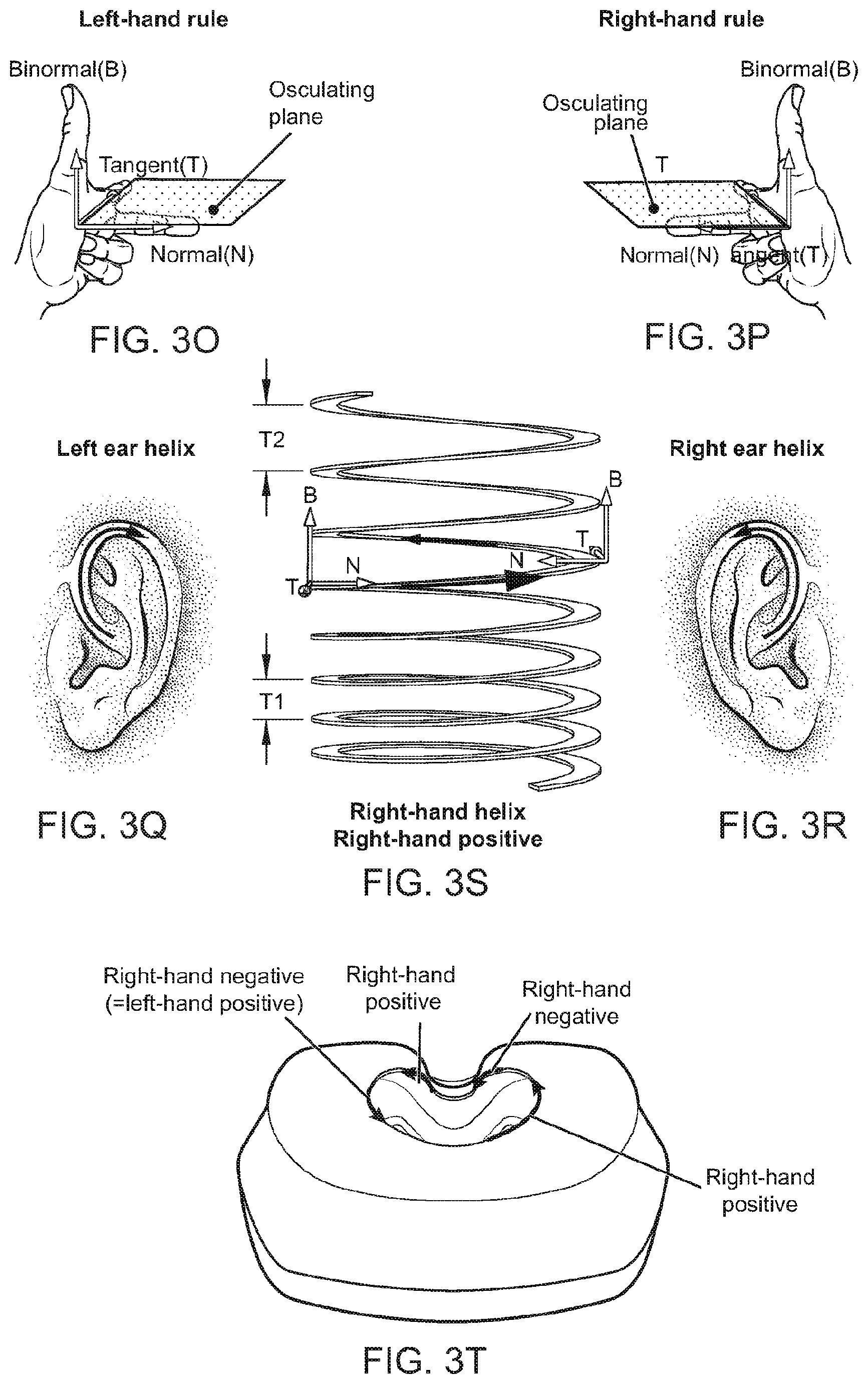 Patent US12496422 Figure 17 – Air delivery conduit