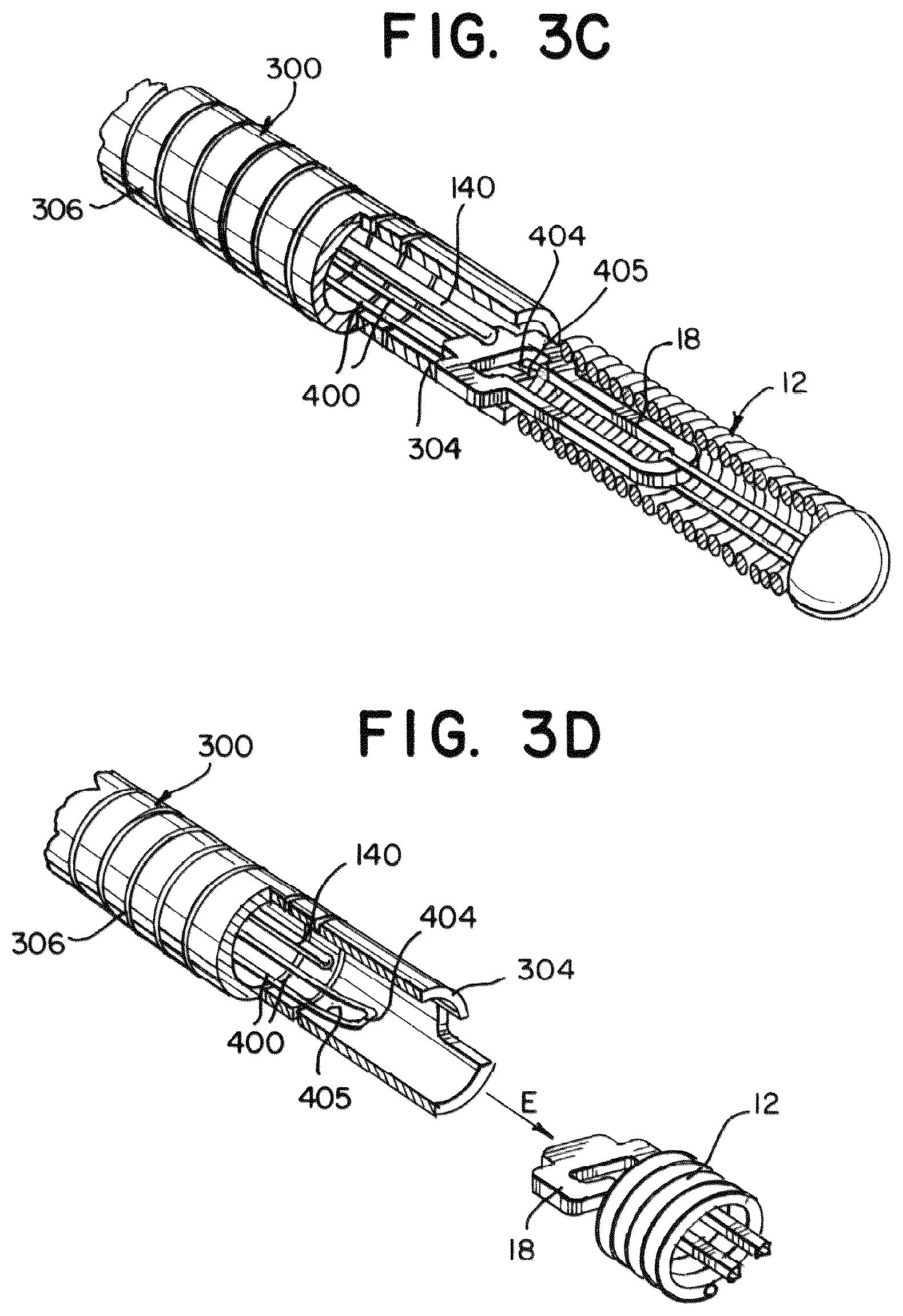 Patent US12496431 Figure 3 – Medical device delivery member with flexible stretch resistant distal portion