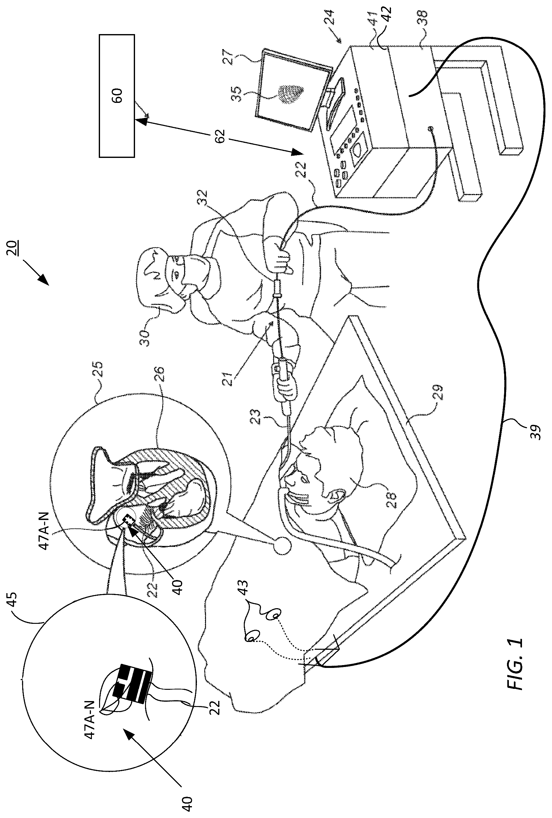Patent US12496432 — Detection of catheter location, orientation, and movement direction — Figure 1