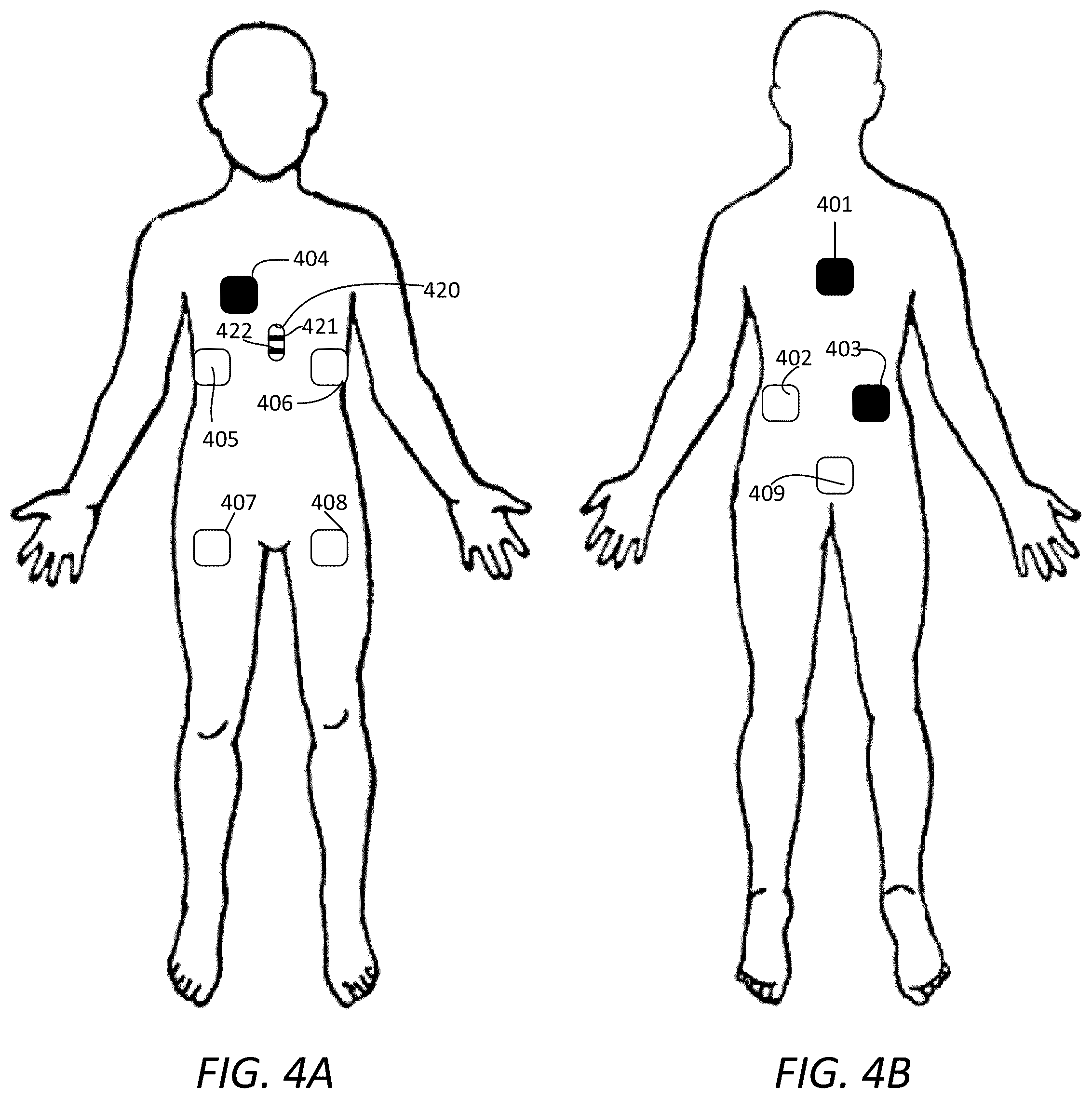 Patent US12496432 Figure 4 – Detection of catheter location, orientation, and movement direction