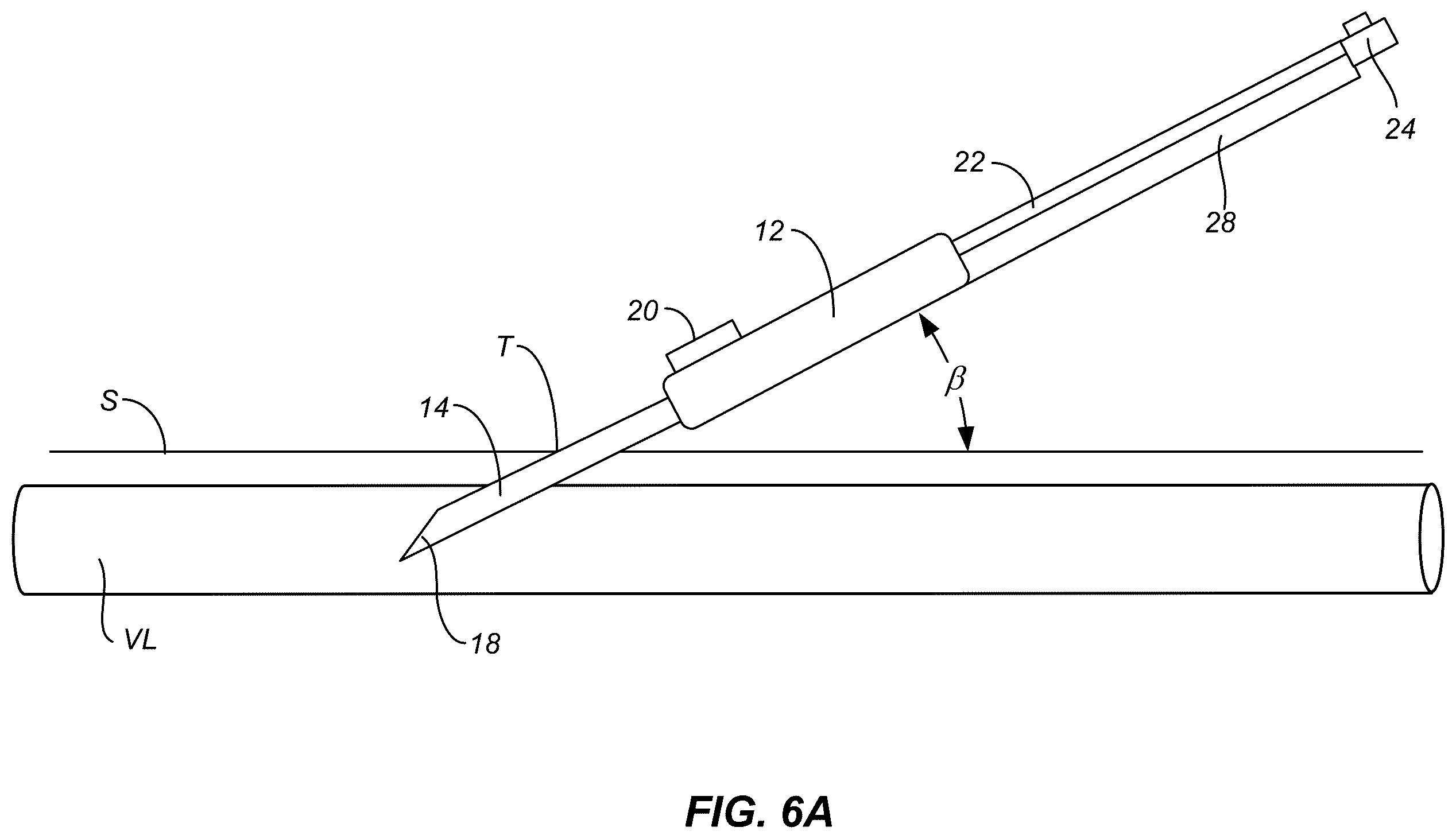 Patent US12496434 Figure 3 – Retractable needle catheter delivery apparatus