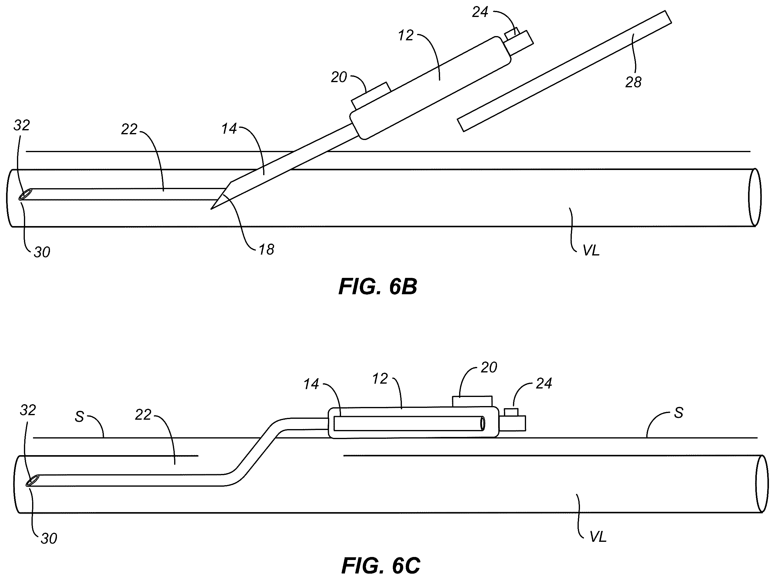 Patent US12496434 Figure 4 – Retractable needle catheter delivery apparatus
