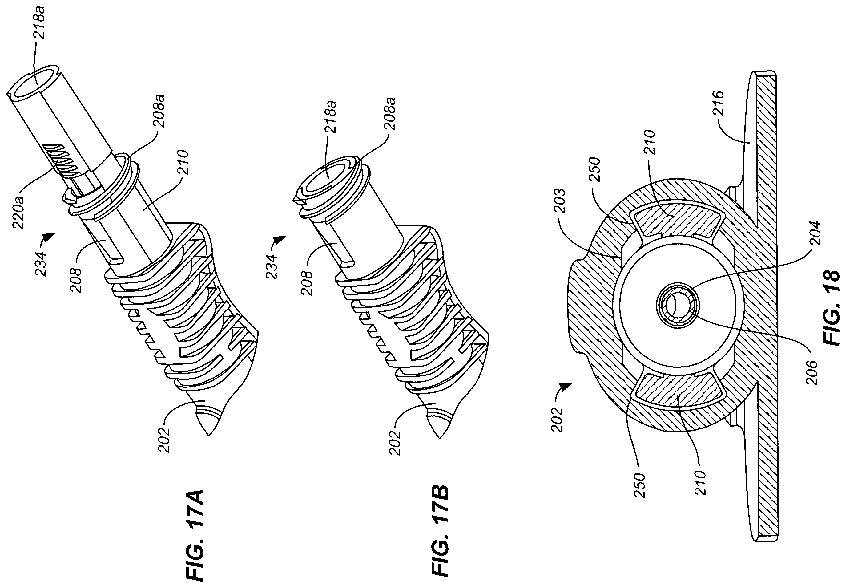 Patent US12496434 Figure 17 – Retractable needle catheter delivery apparatus