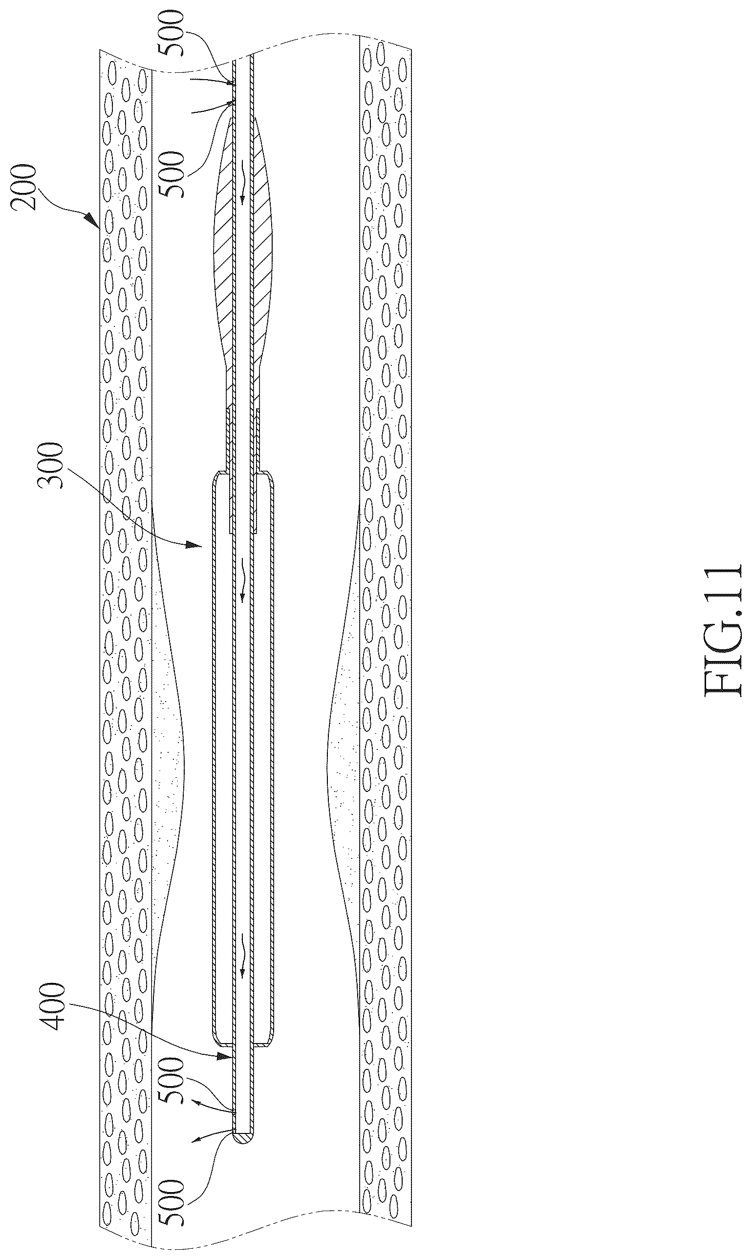 Patent US12496436 Figure 7 – Hollow balloon catheter device for guiding blood flow