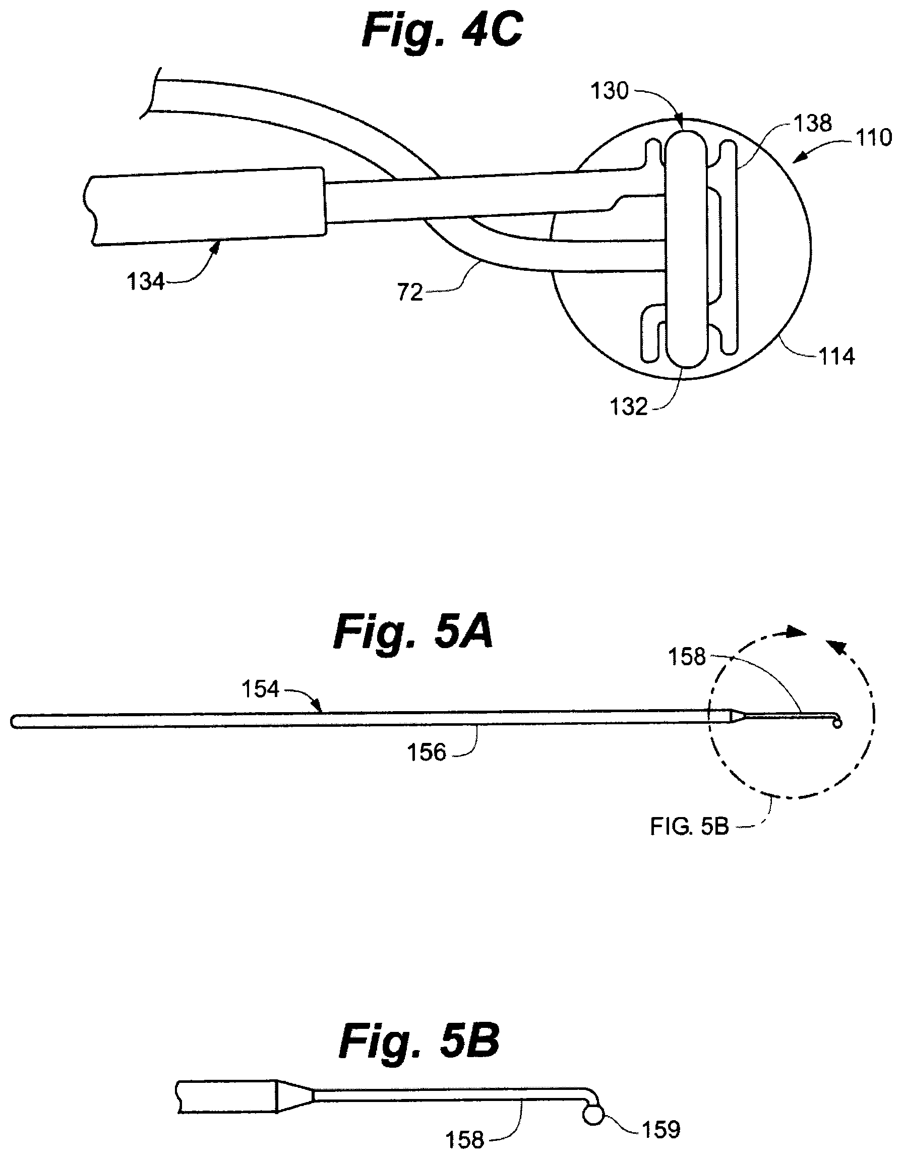 Patent US12496439 Figure 4 – Implant tool and improved electrode design for minimally invasive procedure