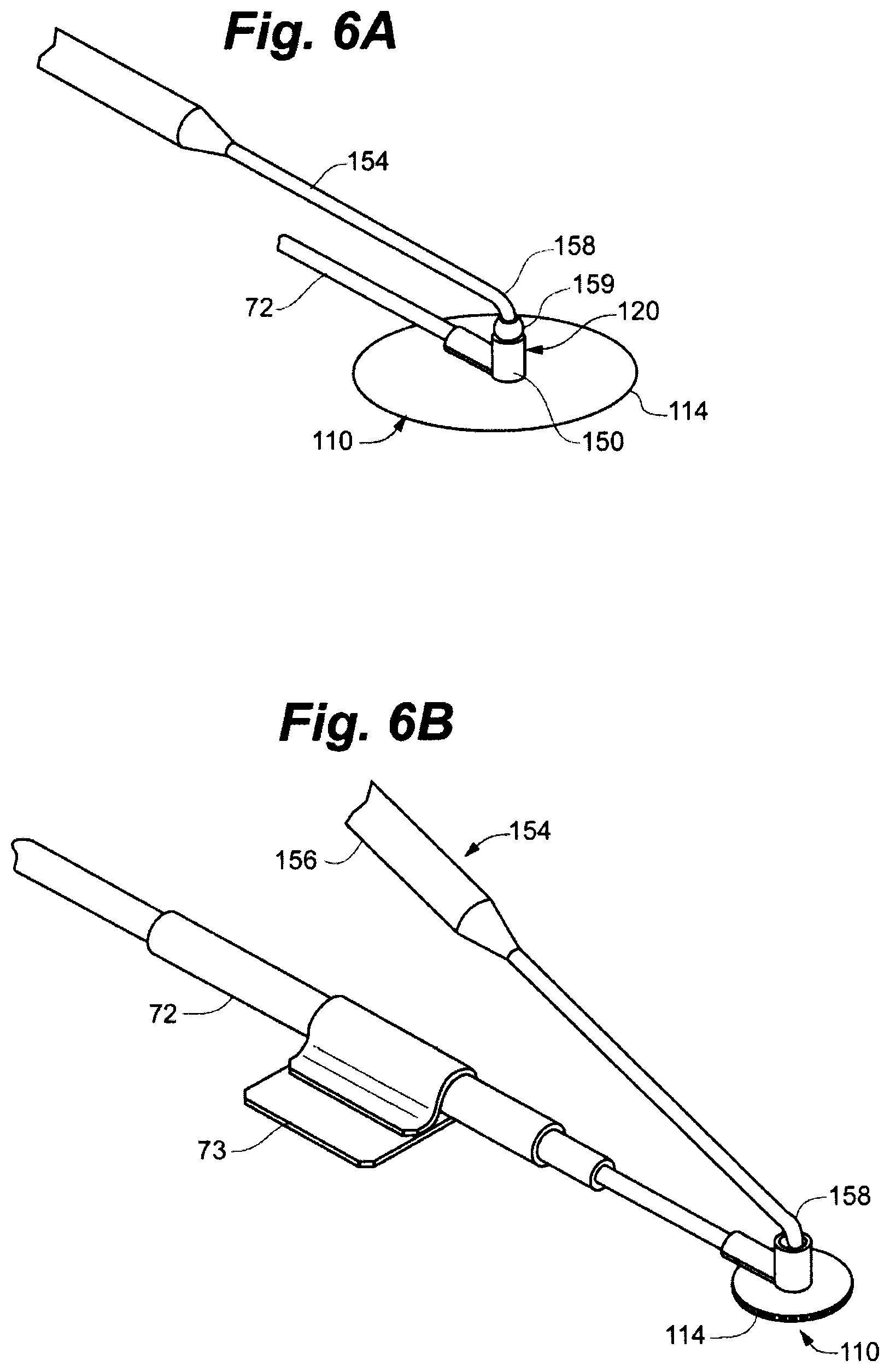Patent US12496439 Figure 5 – Implant tool and improved electrode design for minimally invasive procedure