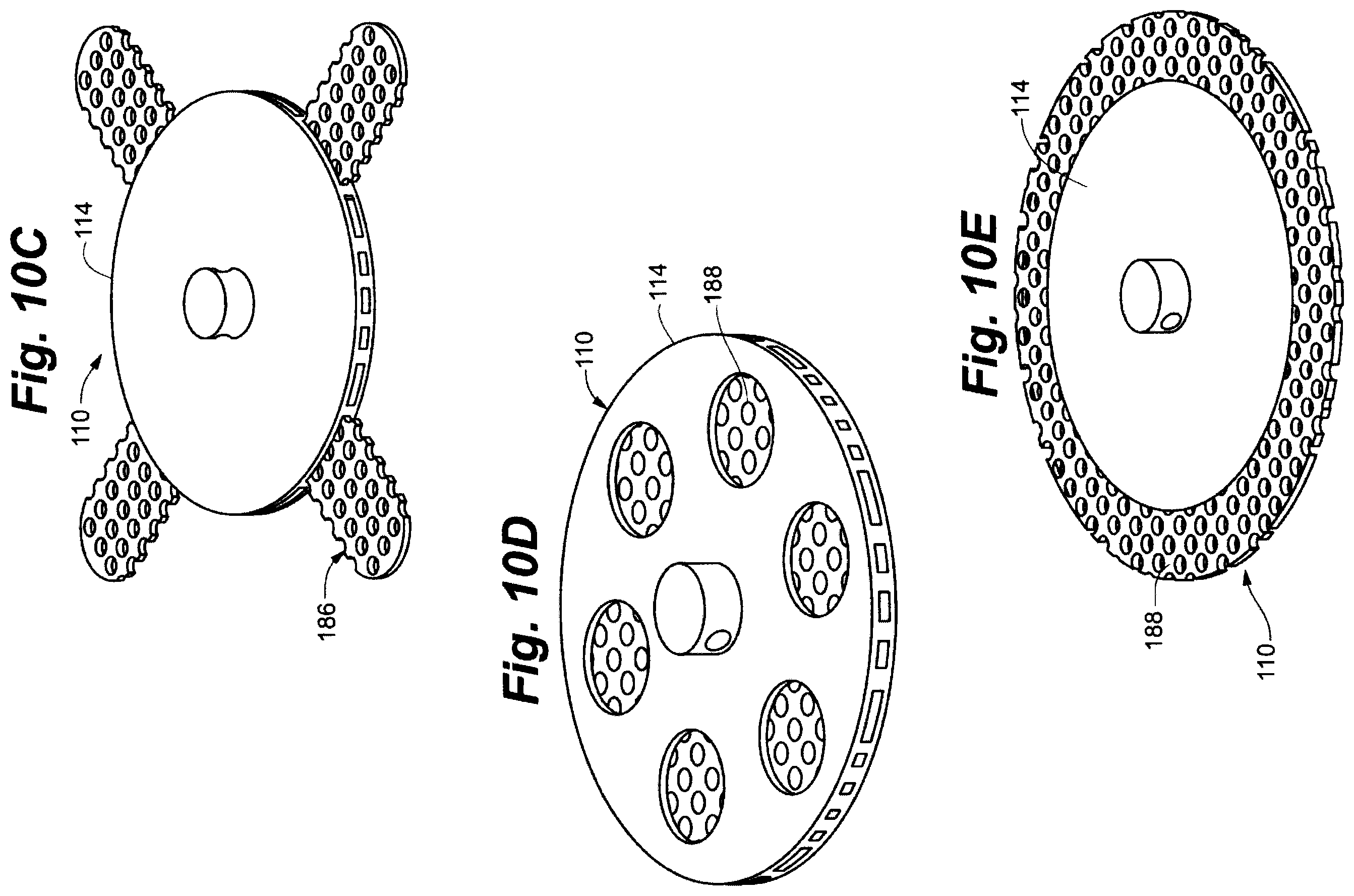 Patent US12496439 Figure 9 – Implant tool and improved electrode design for minimally invasive procedure