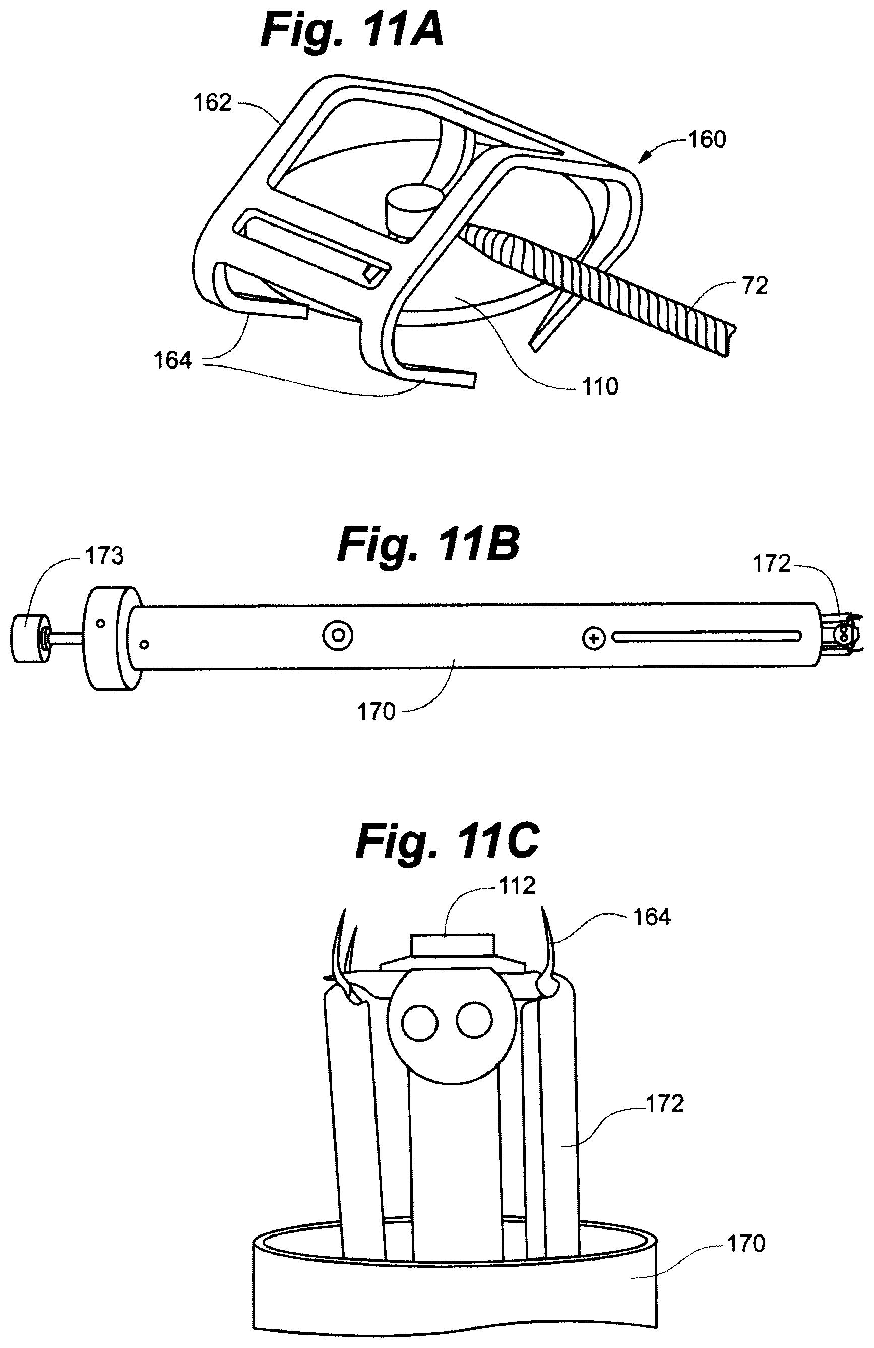 Patent US12496439 Figure 10 – Implant tool and improved electrode design for minimally invasive procedure