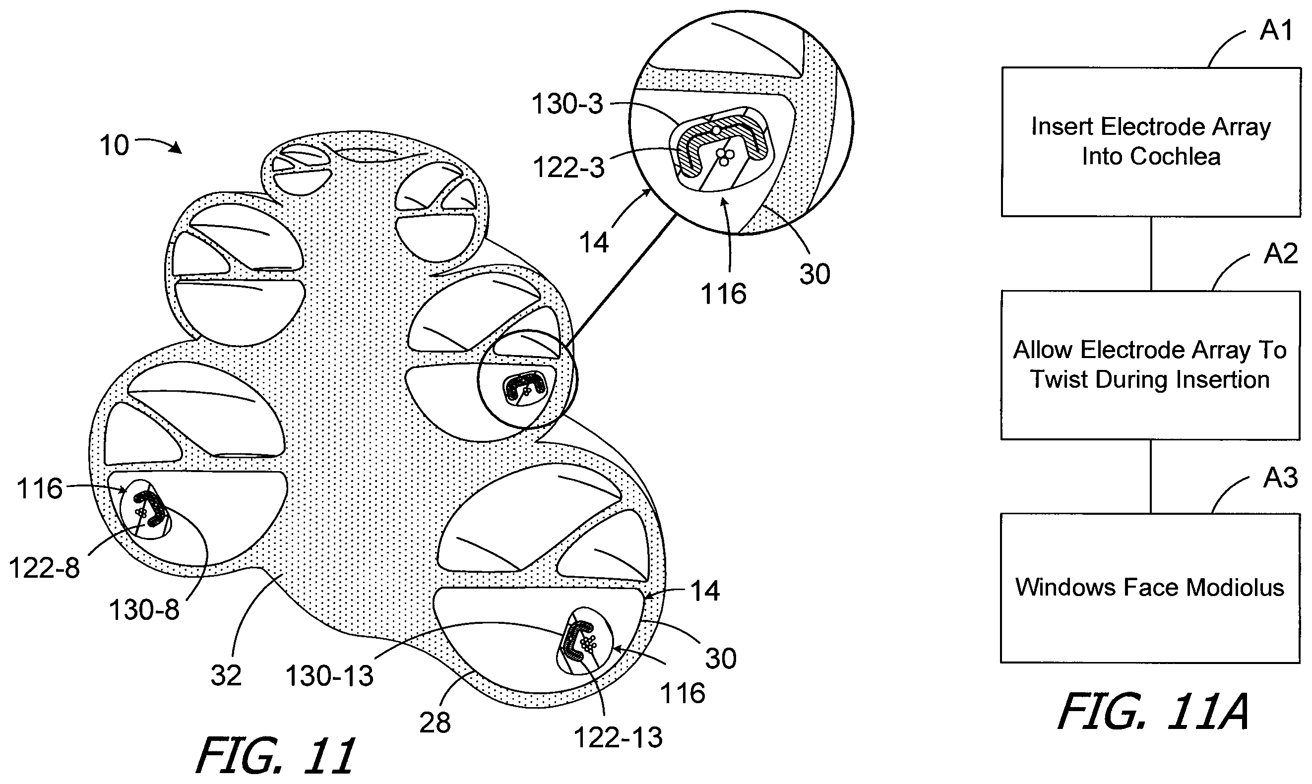 Patent US12496440 Figure 5 – Apparatus and methods for making cochlear implant electrode arrays