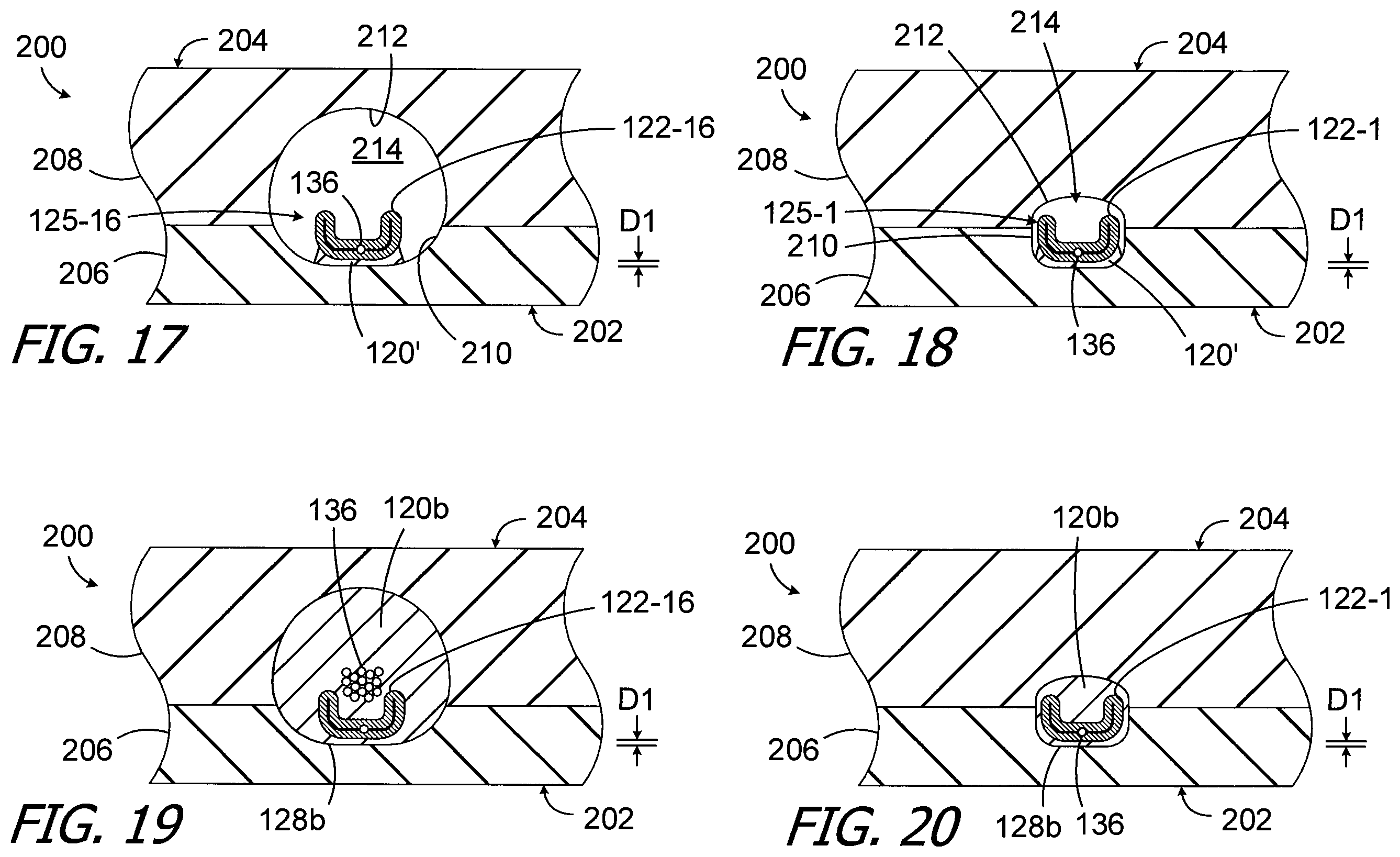 Patent US12496440 Figure 9 – Apparatus and methods for making cochlear implant electrode arrays