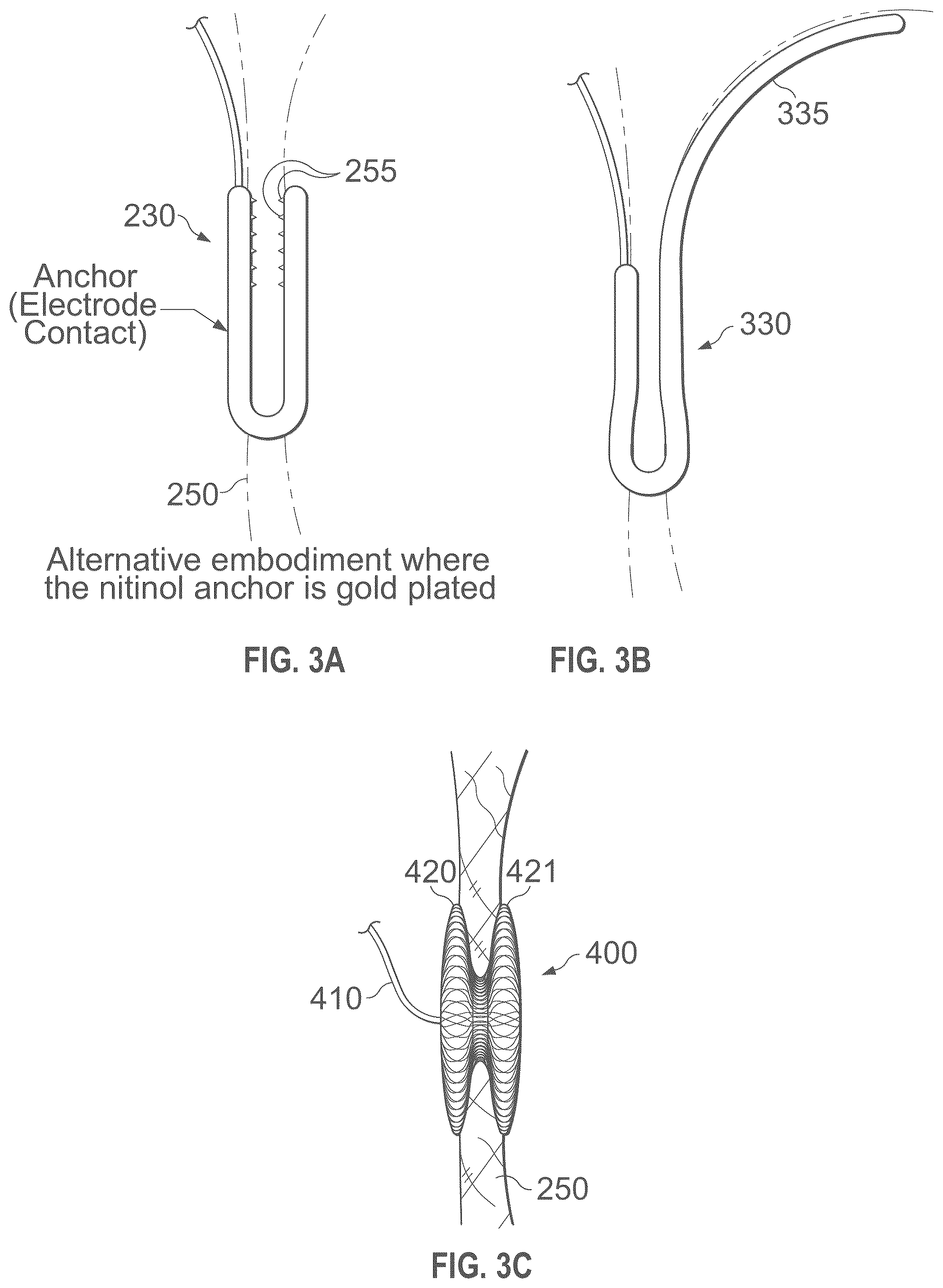 Patent US12496441 Figure 17 – Implantable endovascular, low profile intracardiac left atrial restraining devices for low energy atrial cardioversion, pacing and sensing