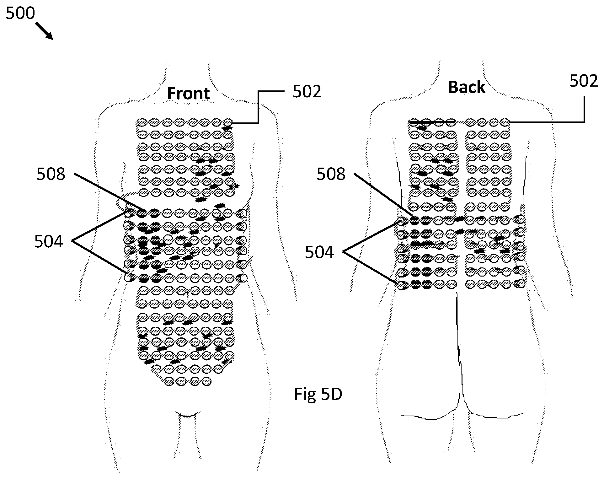 Patent US12496443 Figure 10 – Apparatus and method for improving electric field therapy to reduce solid tumors