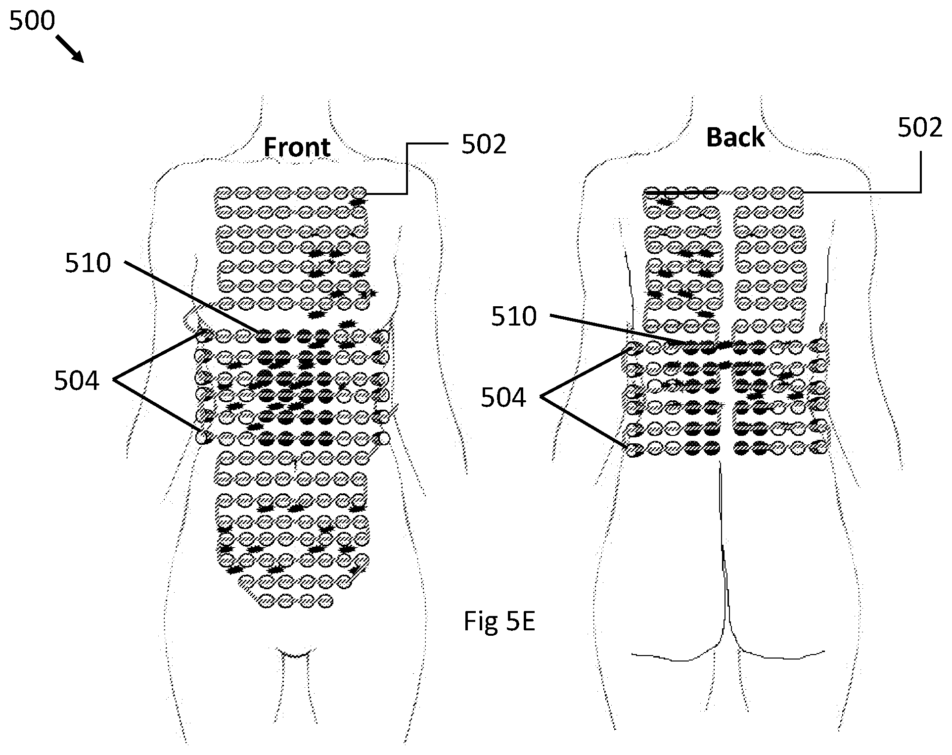 Patent US12496443 Figure 11 – Apparatus and method for improving electric field therapy to reduce solid tumors