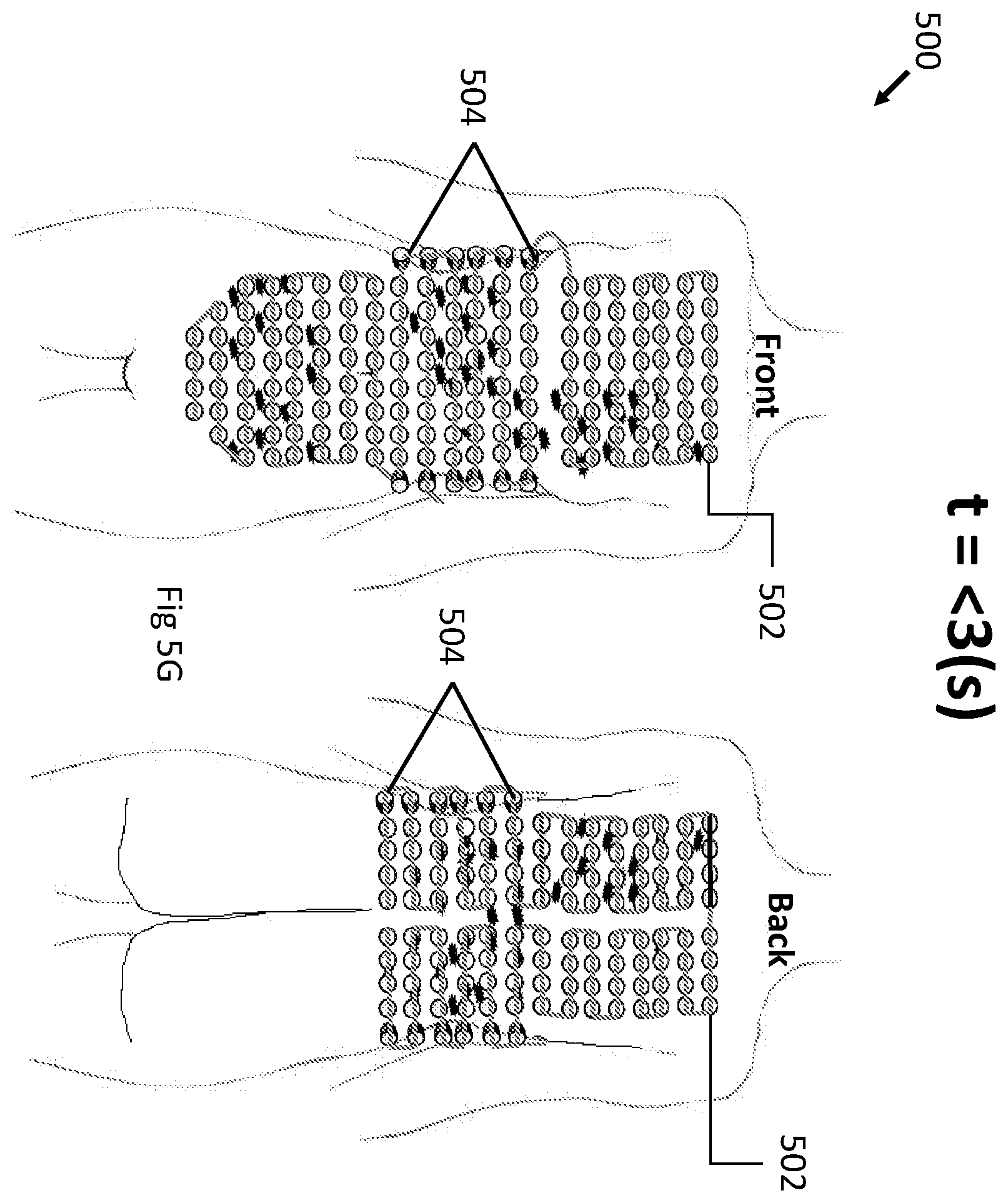 Patent US12496443 Figure 13 – Apparatus and method for improving electric field therapy to reduce solid tumors