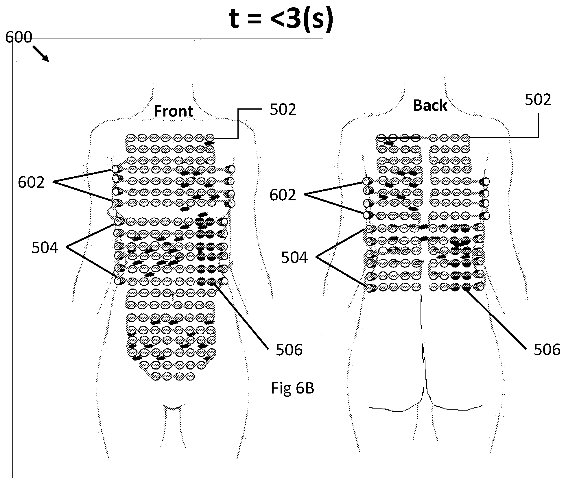 Patent US12496443 Figure 15 – Apparatus and method for improving electric field therapy to reduce solid tumors