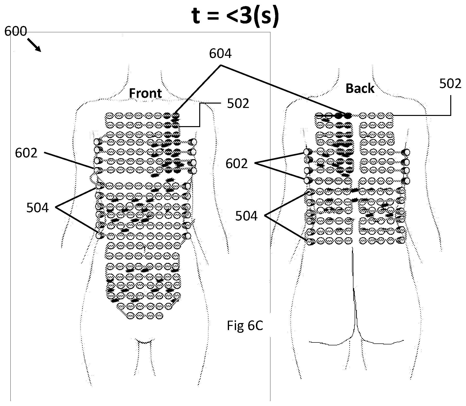 Patent US12496443 Figure 16 – Apparatus and method for improving electric field therapy to reduce solid tumors