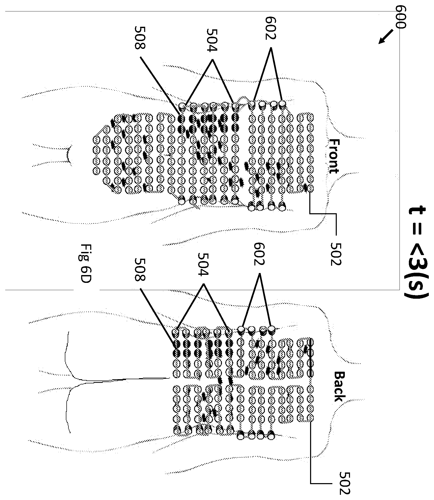 Patent US12496443 Figure 17 – Apparatus and method for improving electric field therapy to reduce solid tumors