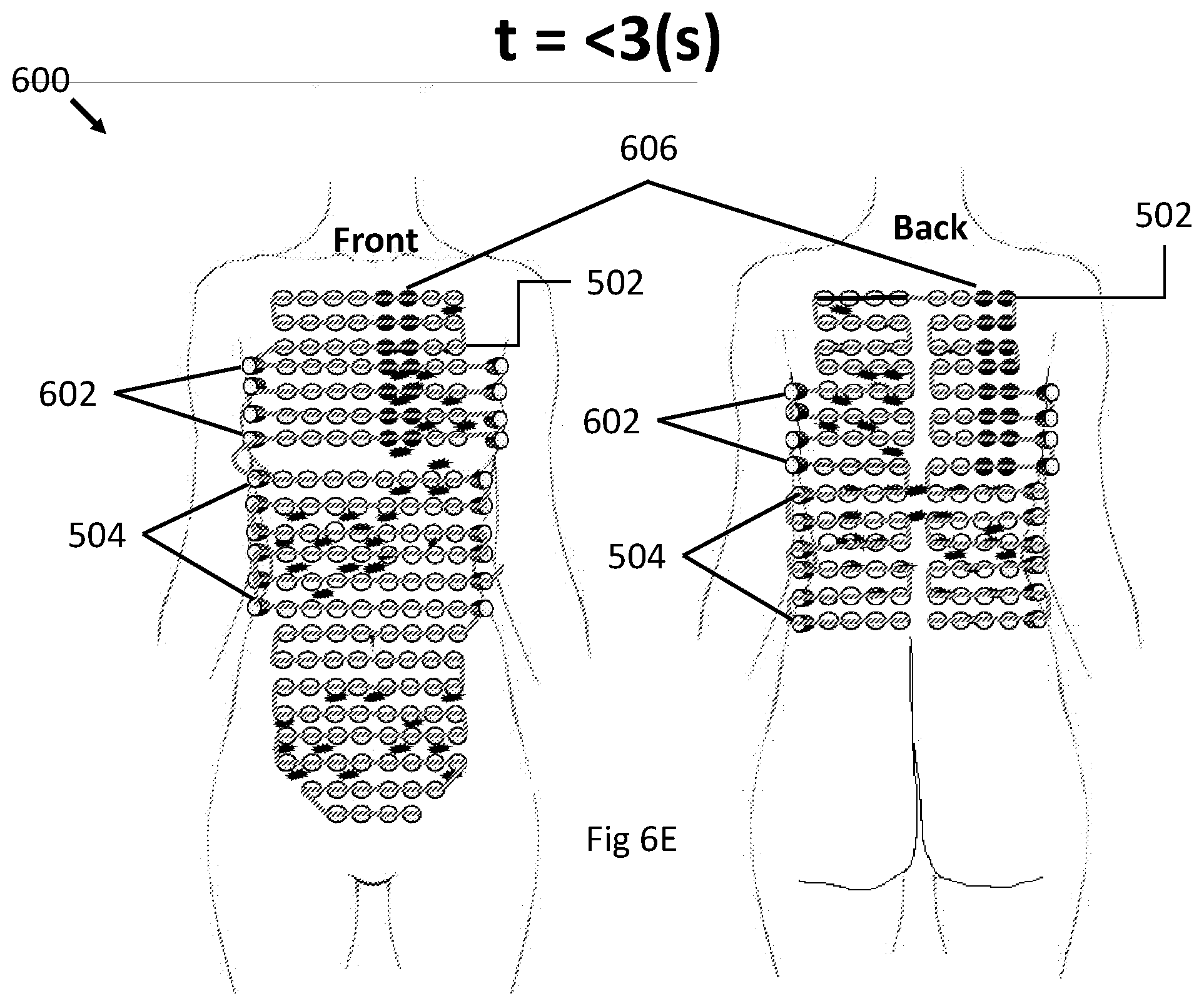 Patent US12496443 Figure 18 – Apparatus and method for improving electric field therapy to reduce solid tumors