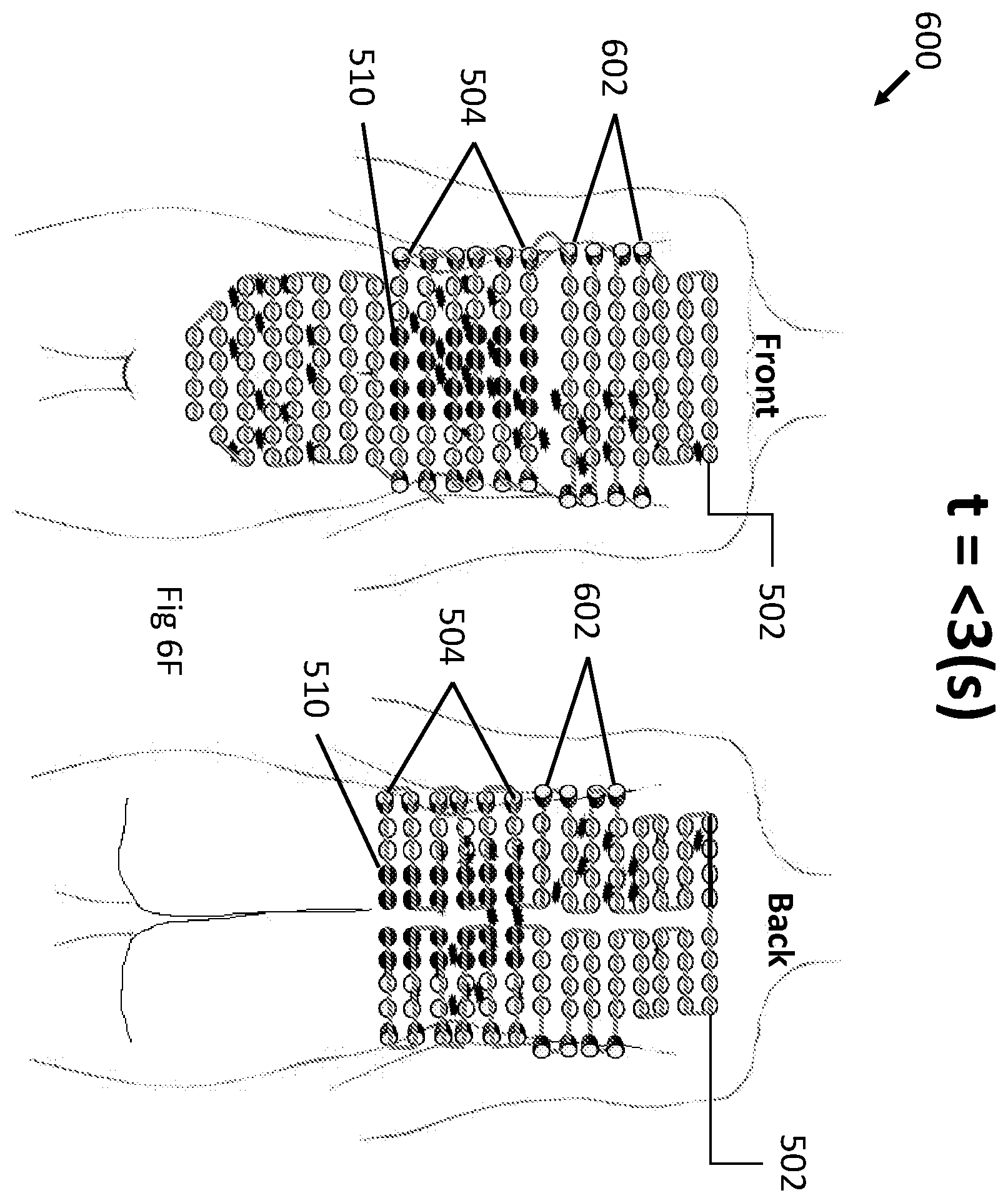 Patent US12496443 Figure 19 – Apparatus and method for improving electric field therapy to reduce solid tumors
