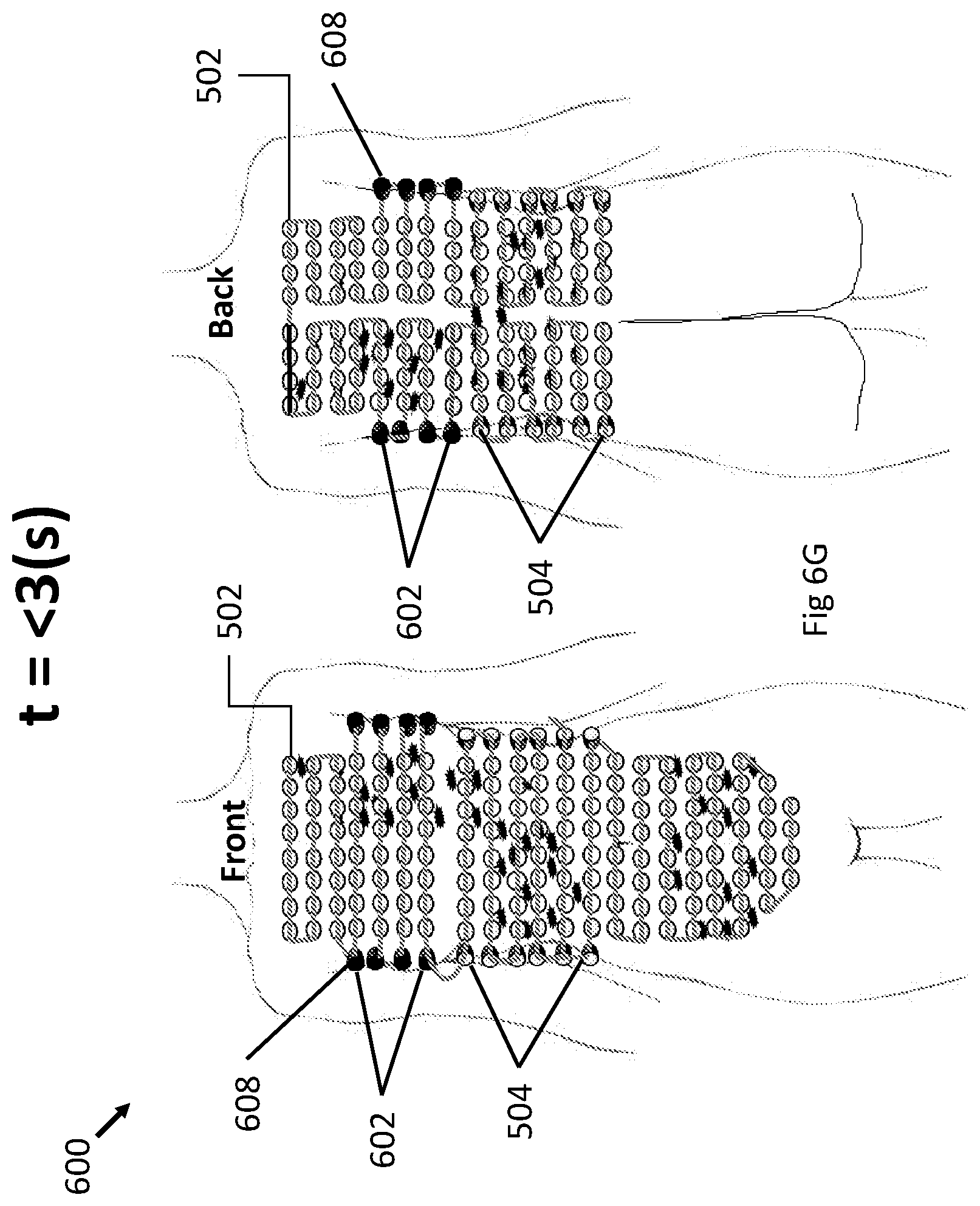 Patent US12496443 Figure 20 – Apparatus and method for improving electric field therapy to reduce solid tumors