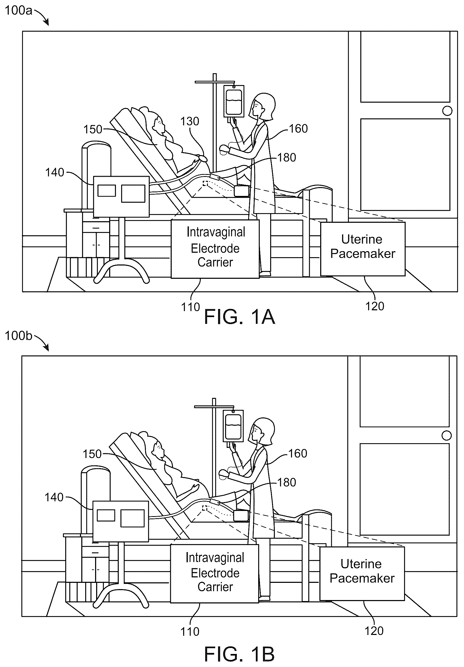 Patent US12496444 Figure 1 – Electrical muscle controller system for uterine contraction monitoring and modulation