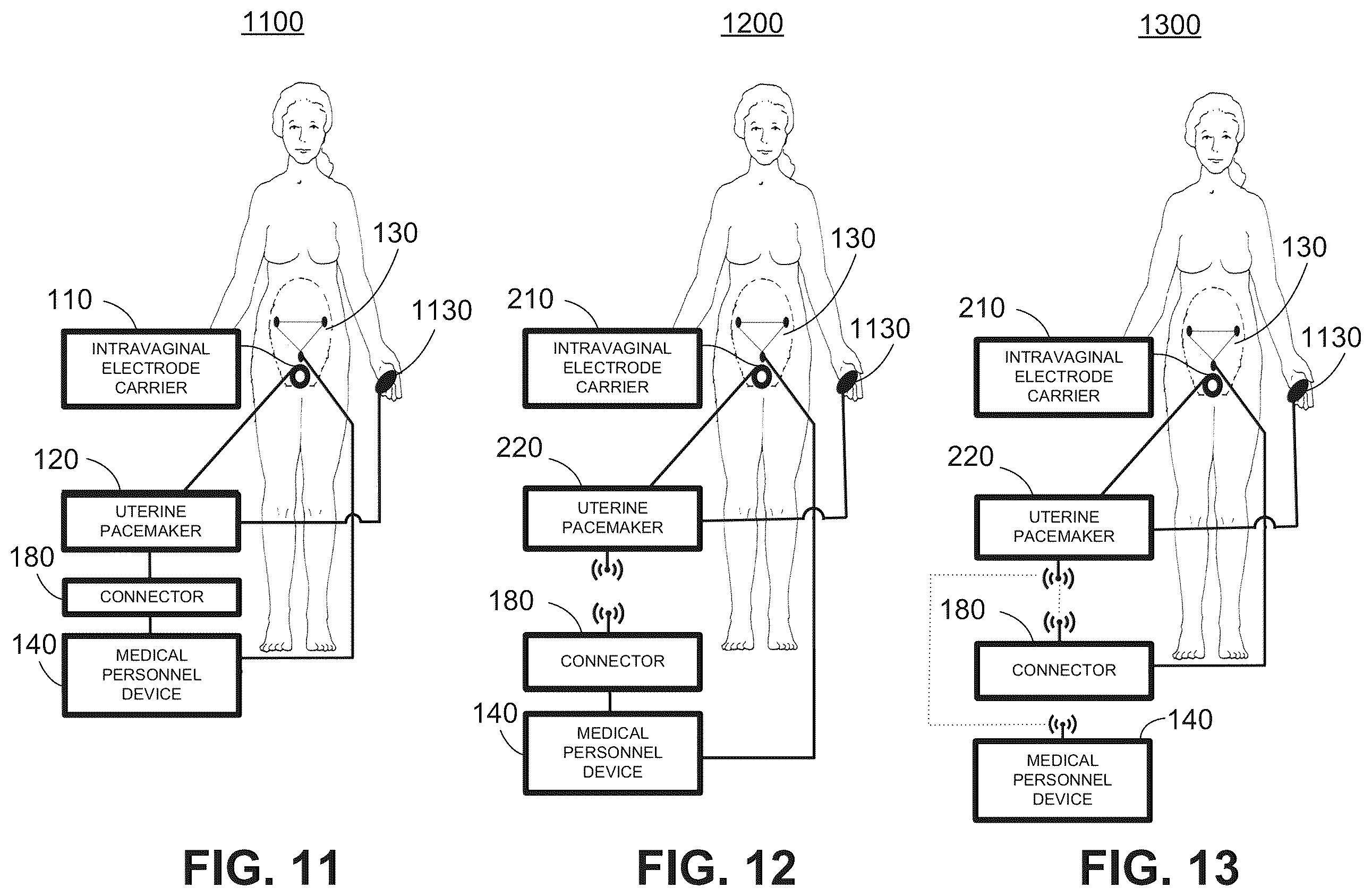 Patent US12496444 Figure 12 – Electrical muscle controller system for uterine contraction monitoring and modulation