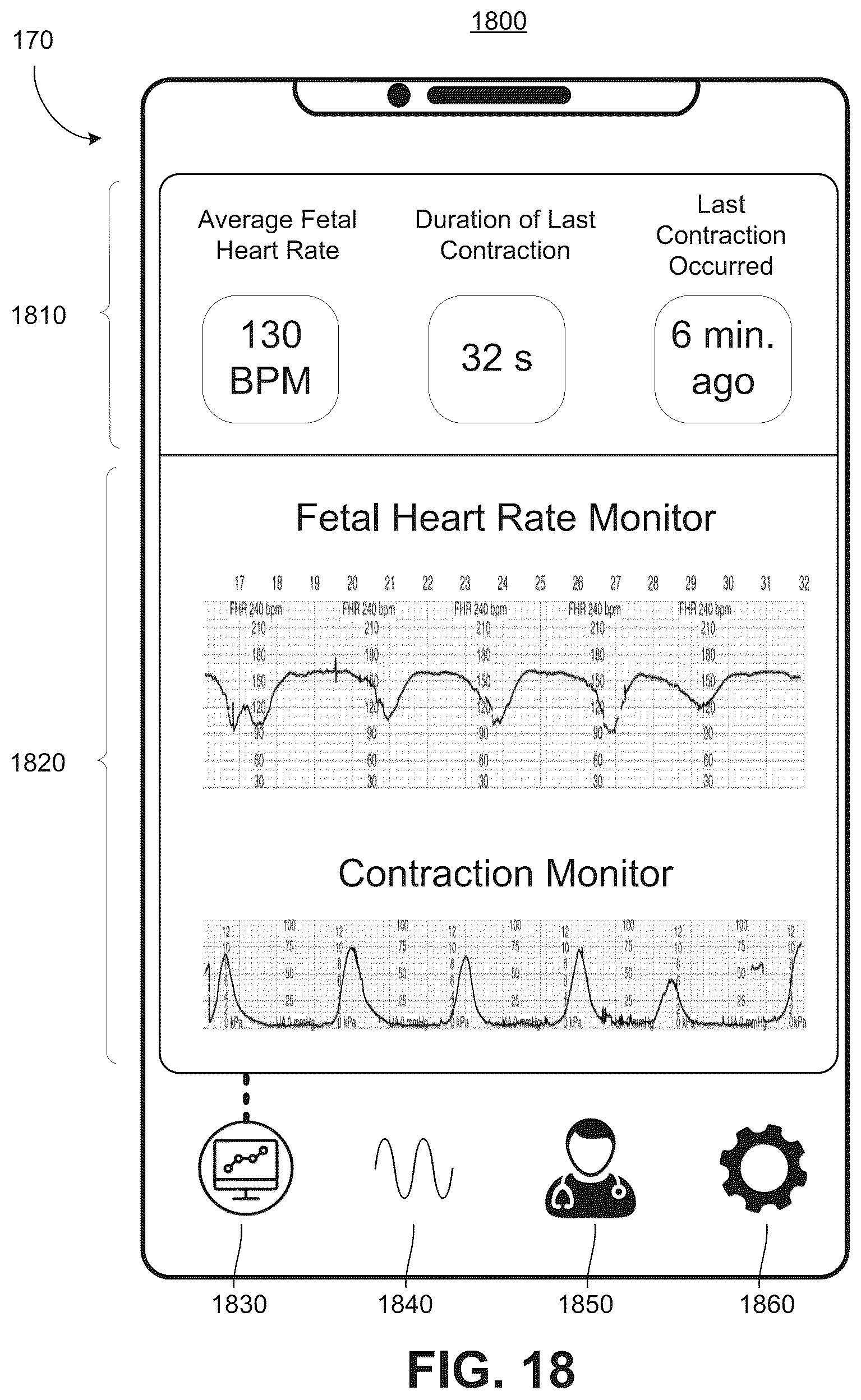 Patent US12496444 Figure 18 – Electrical muscle controller system for uterine contraction monitoring and modulation
