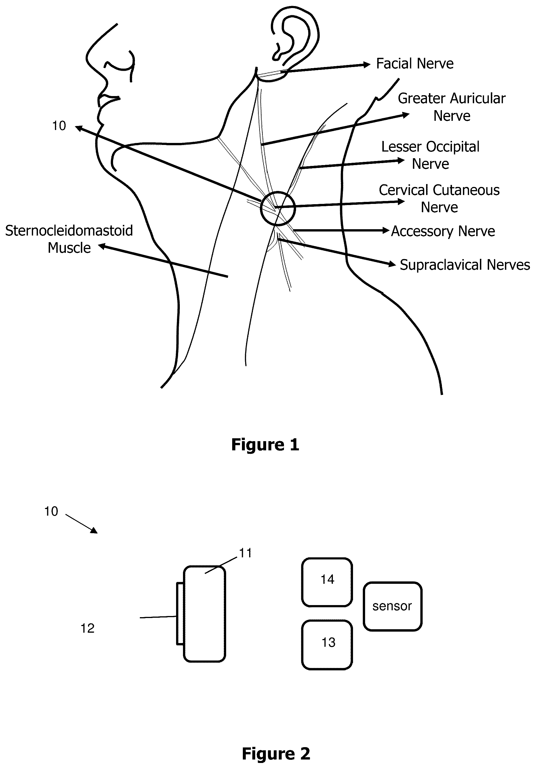 Patent US12496445 Figure 1 – Non-invasive stimulation system for synchronous stimulation of sternocleidomastoid muscles and cutaneous cervical nerve branches with autonomic connections