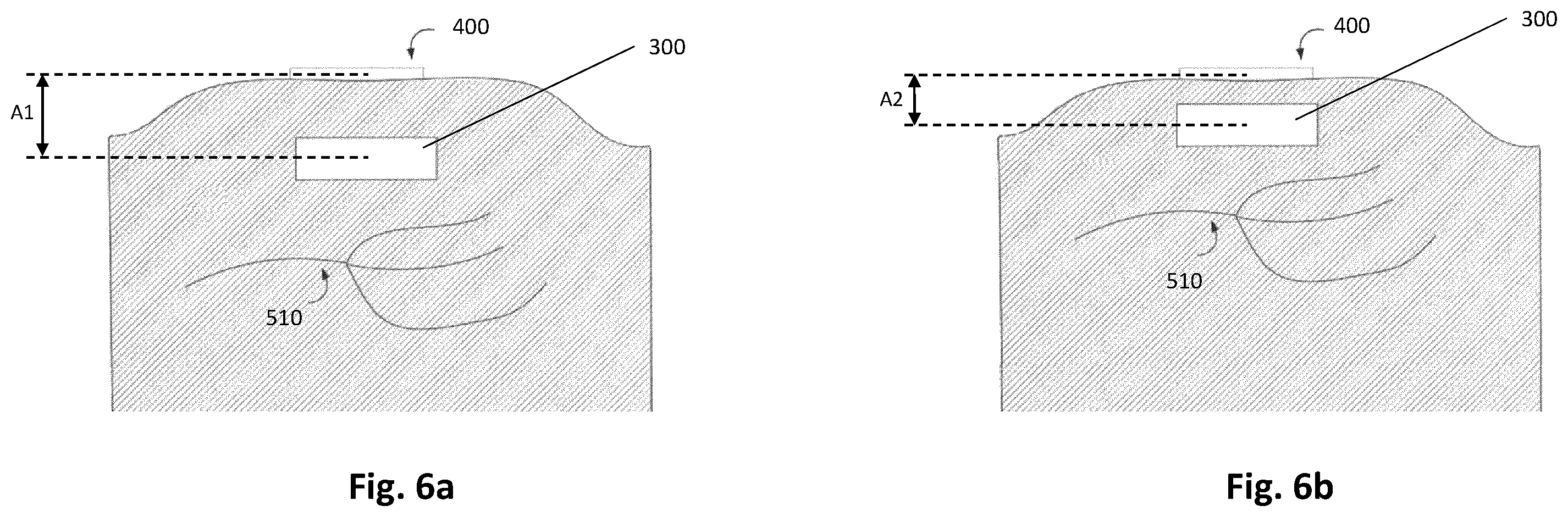 Patent US12496448 Figure 6 – Method and system for electrical nerve stimulation