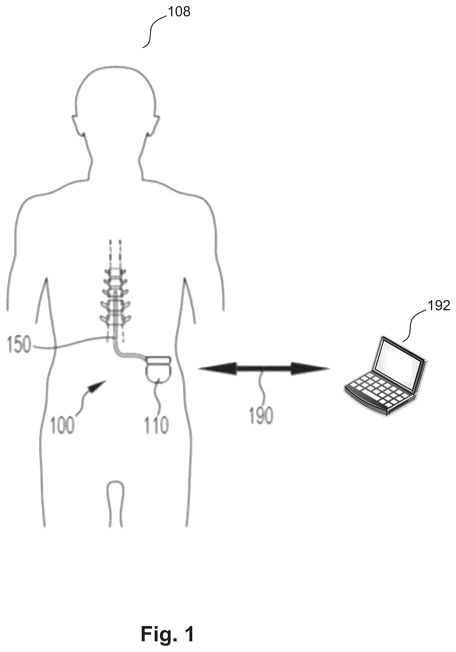 Patent US12496449 Figure 1 – Detection of neural responses to neurostimulation
