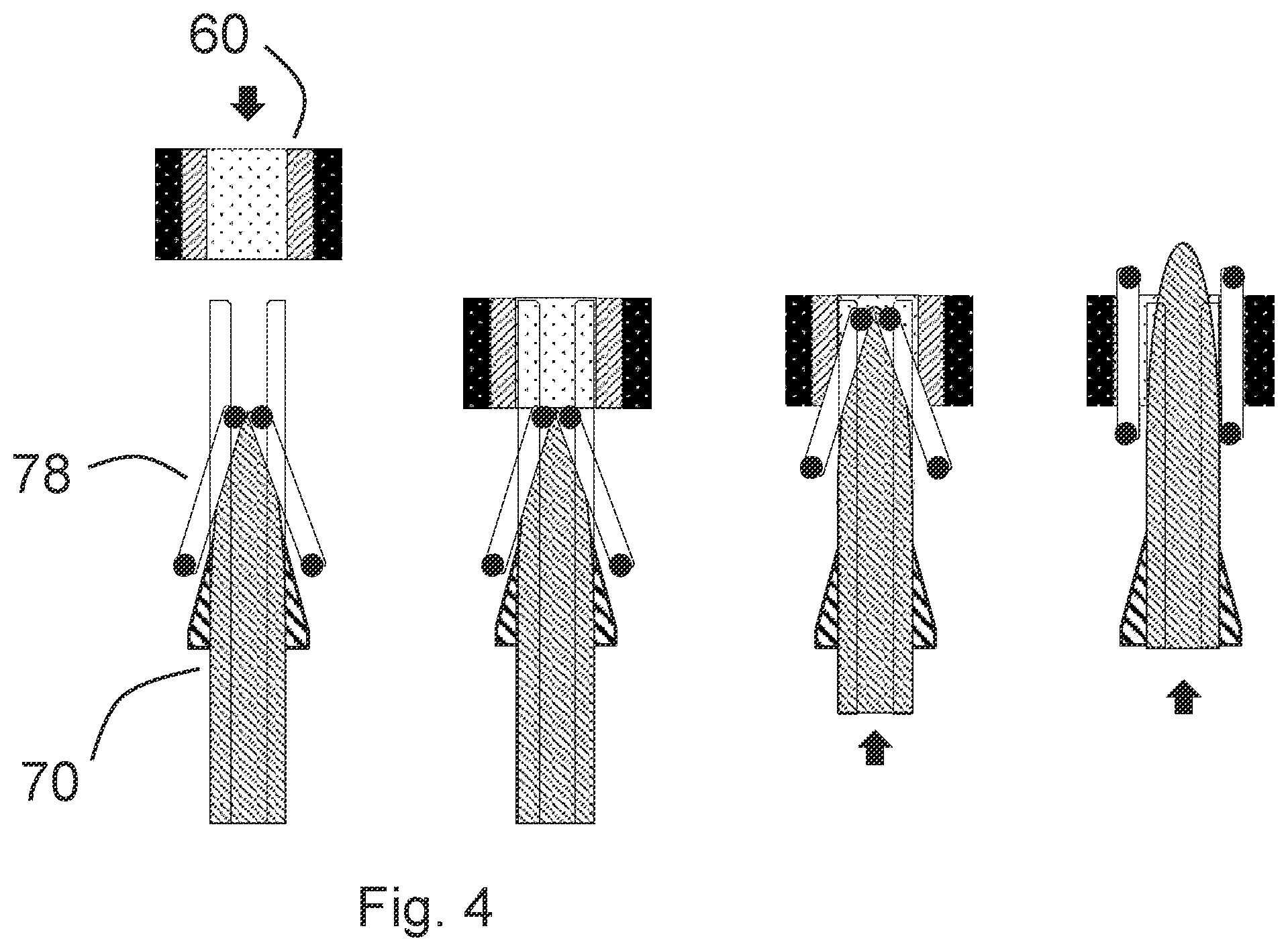 Patent US12496456 Figure 4 – Plasma applicator