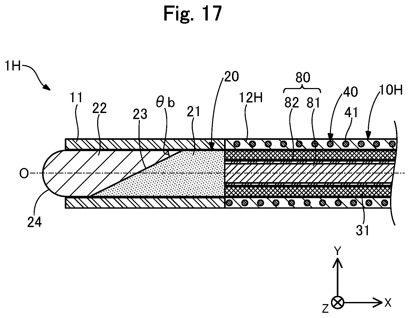 Patent US12496459 Figure 17 – Light irradiation device and light irradiation system