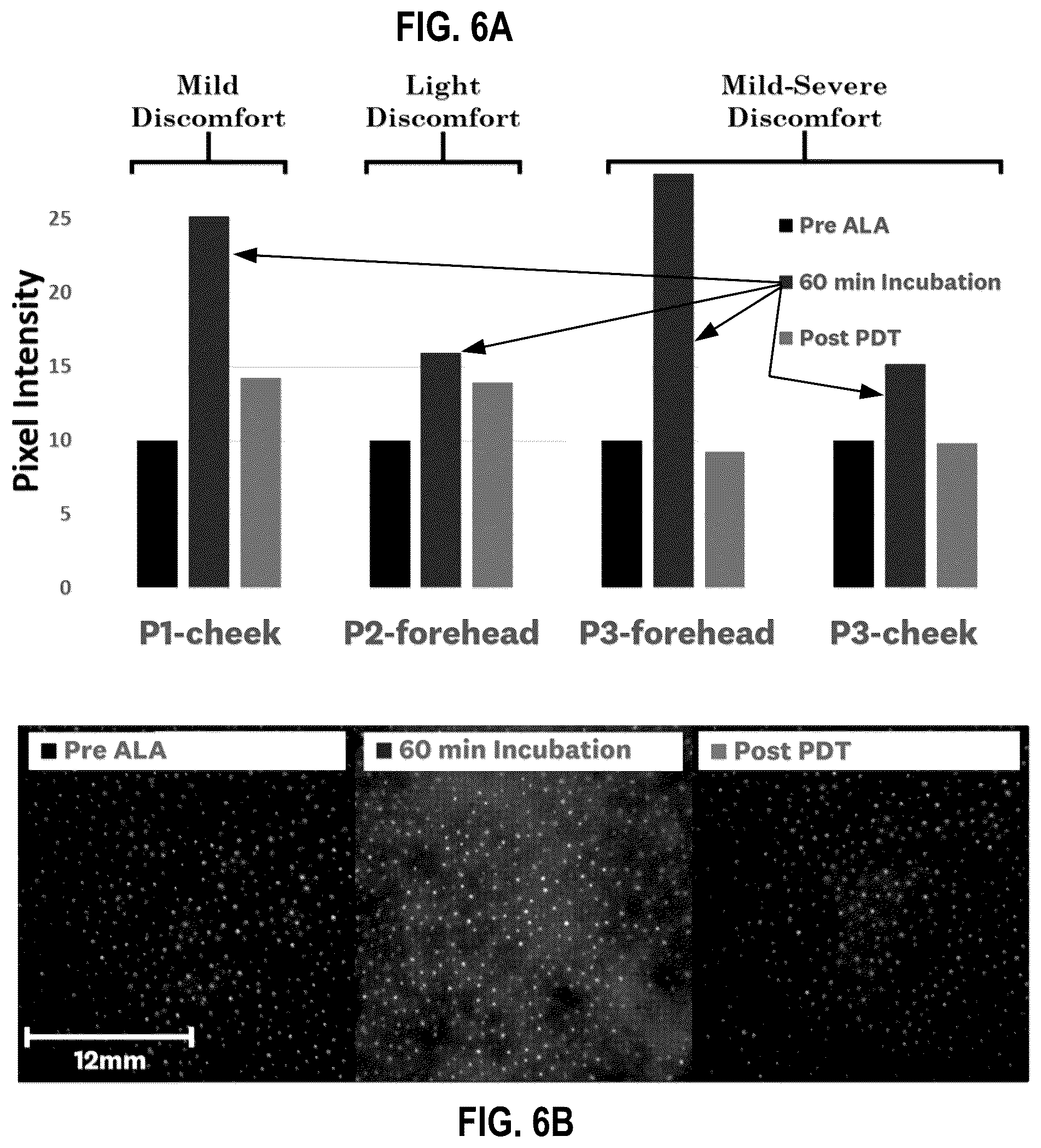 Patent US12496460 Figure 6 – System and method for quantitative dosimetry of photodynamic therapy in skin