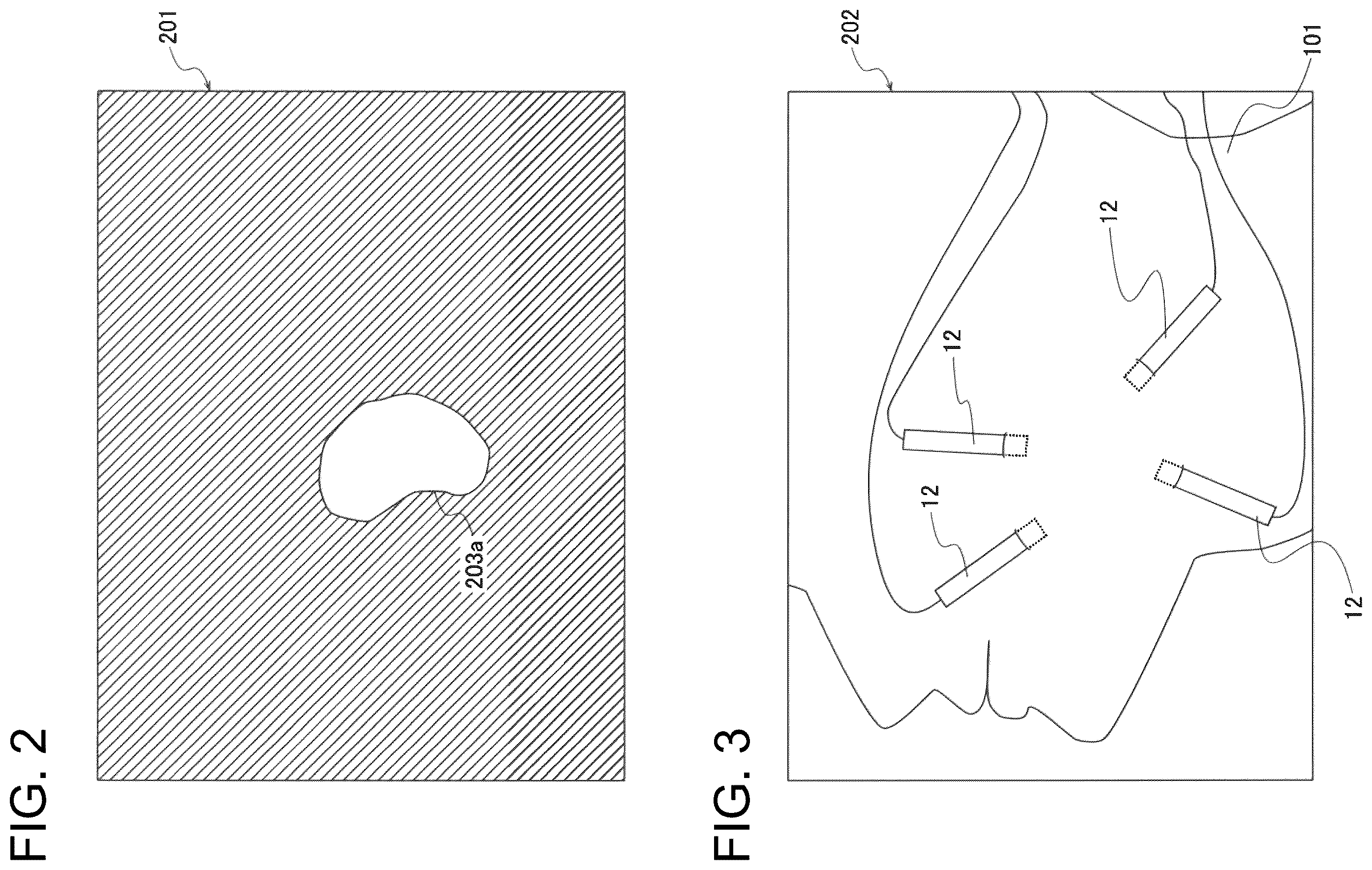 Patent US12496461 Figure 2 – Treatment support system and treatment support device