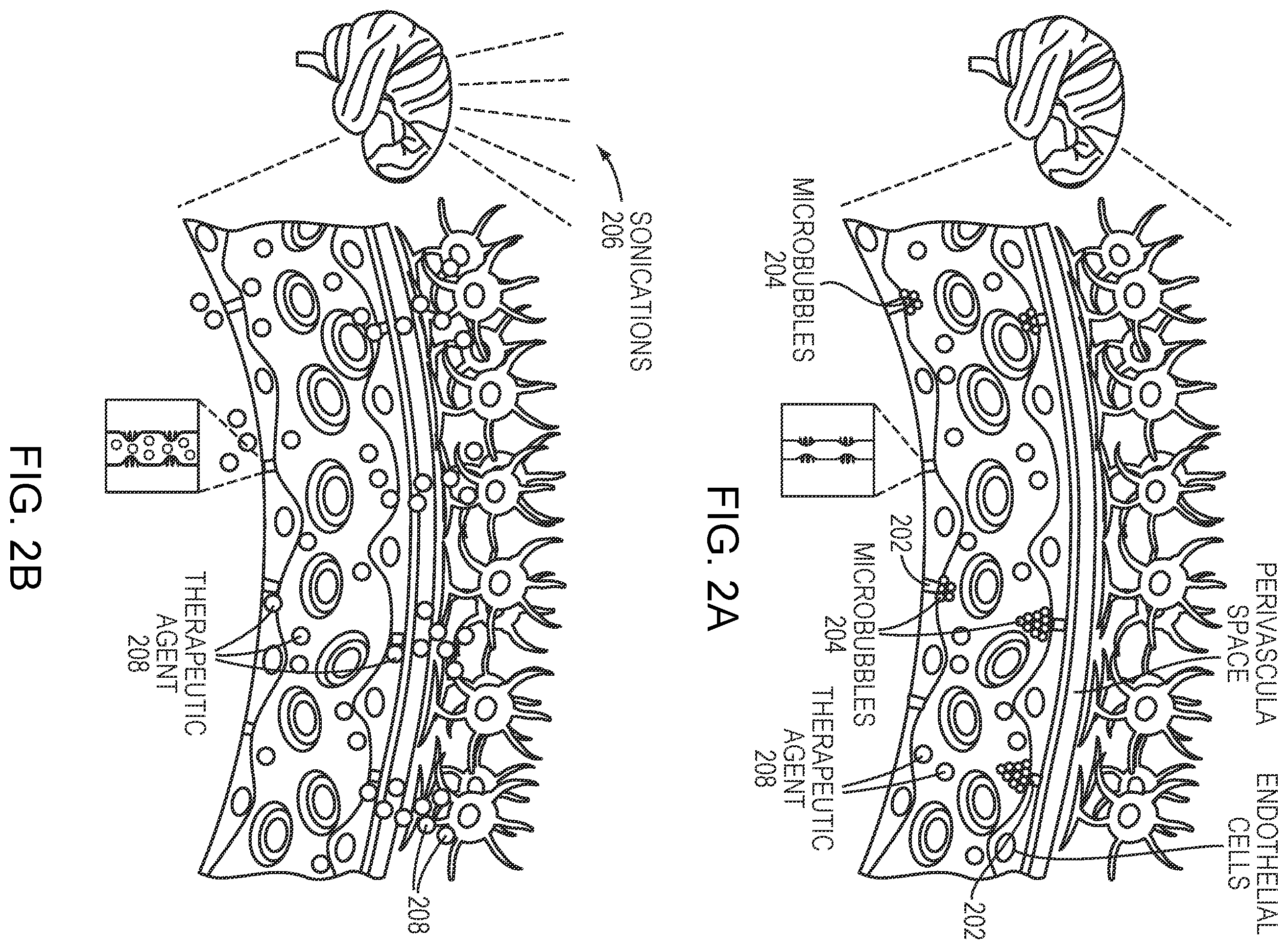 Patent US12496466 Figure 2 – Simulation-based drug treatment planning