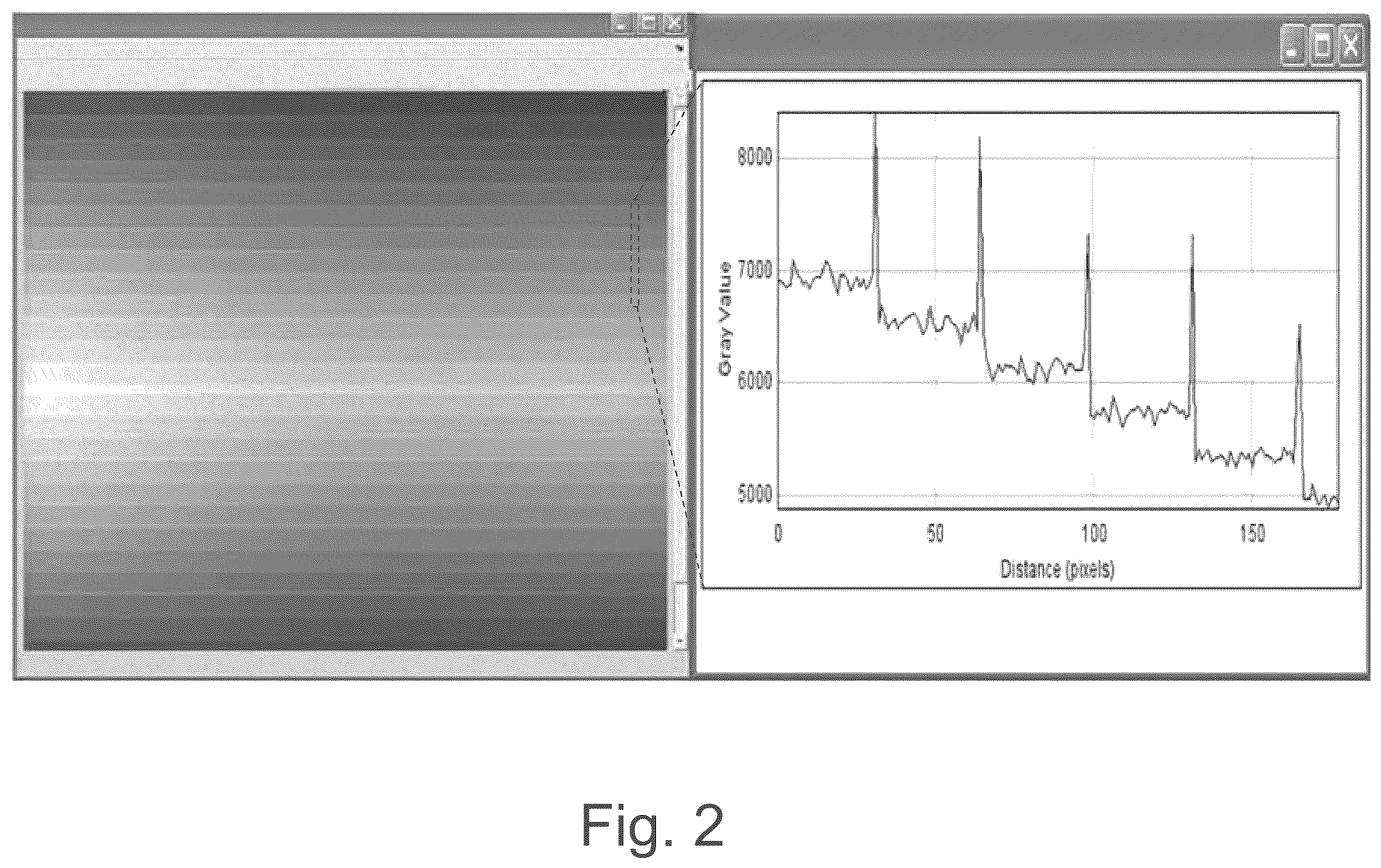 Patent US12496467 Figure 2 – Removing artefacts in radiotherapy imaging