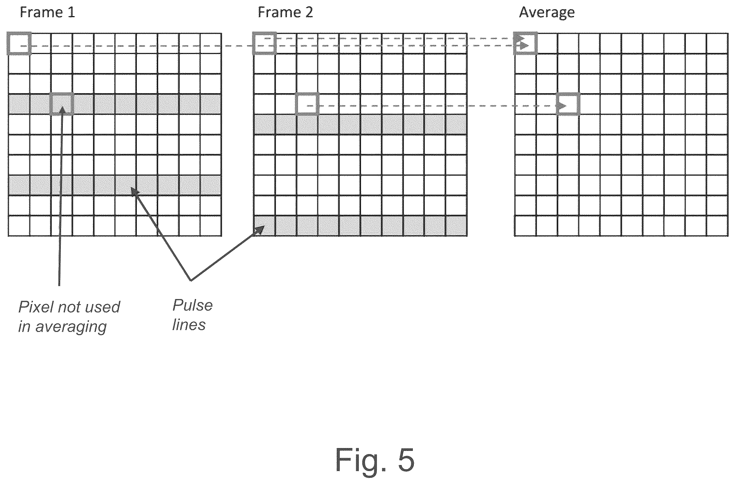Patent US12496467 Figure 4 – Removing artefacts in radiotherapy imaging