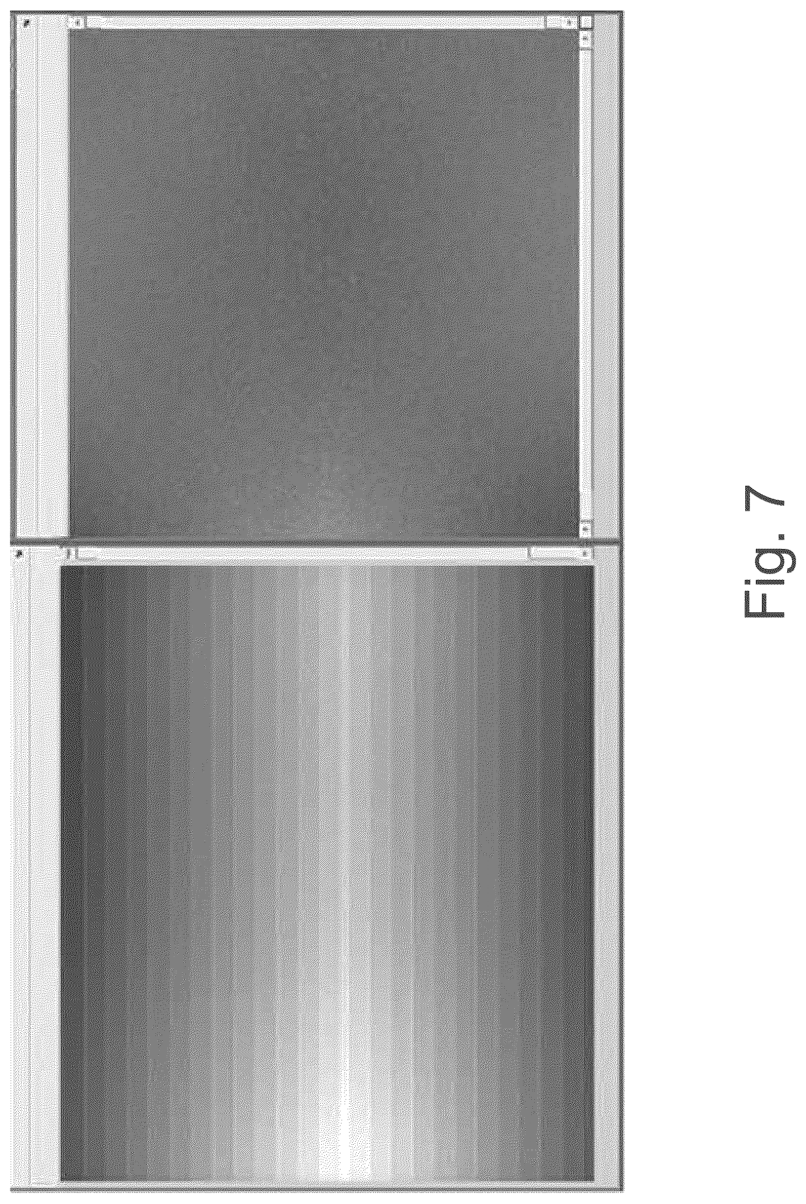 Patent US12496467 Figure 6 – Removing artefacts in radiotherapy imaging
