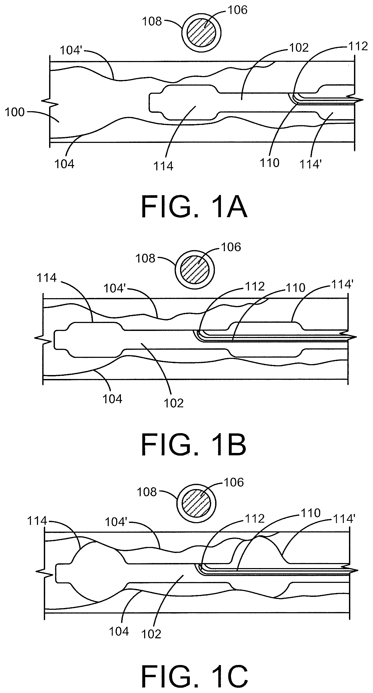 Patent US12496469 Figure 1 – Devices and methods for endoluminal delivery of either fluid or energy for denervation