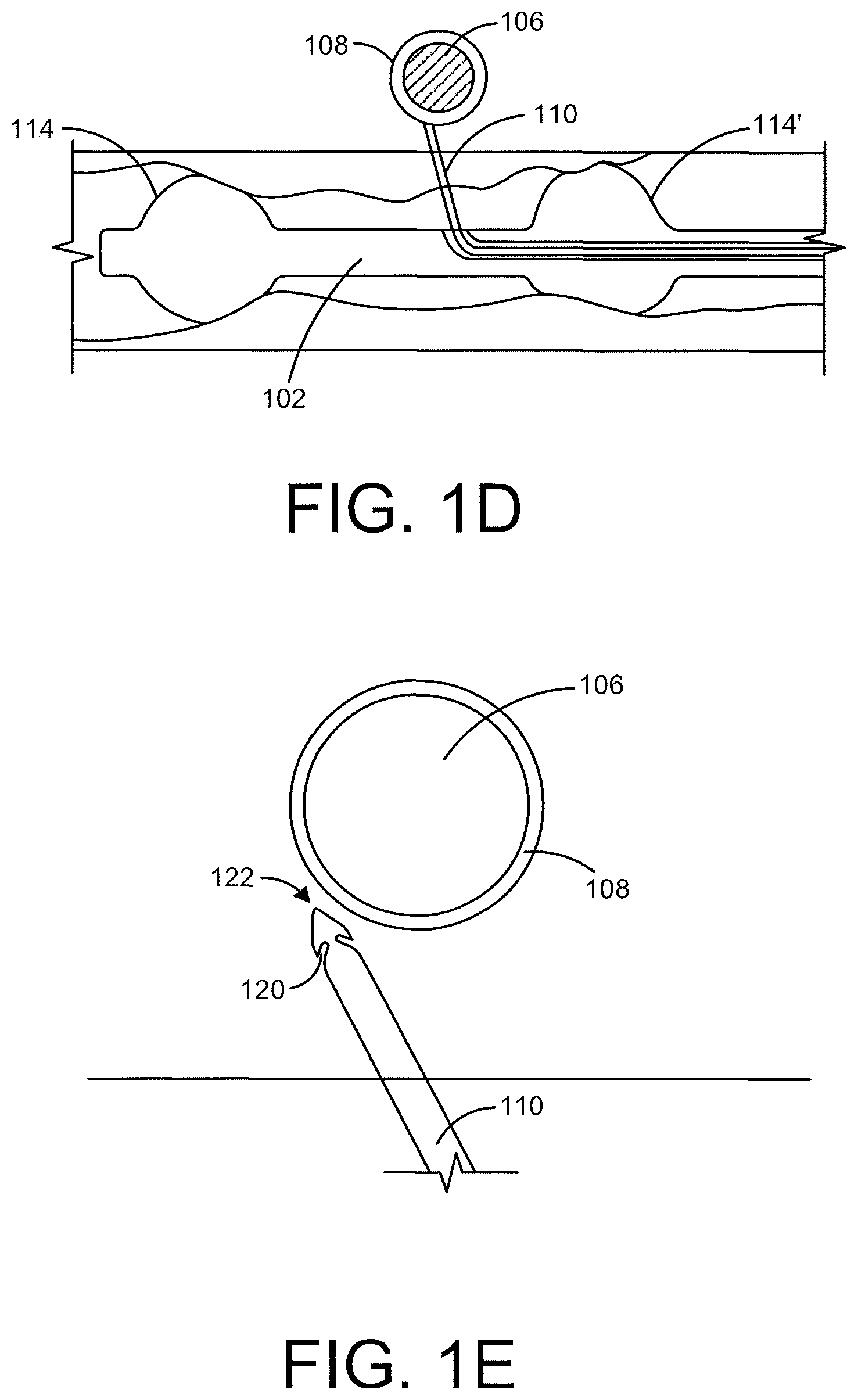 Patent US12496469 Figure 2 – Devices and methods for endoluminal delivery of either fluid or energy for denervation